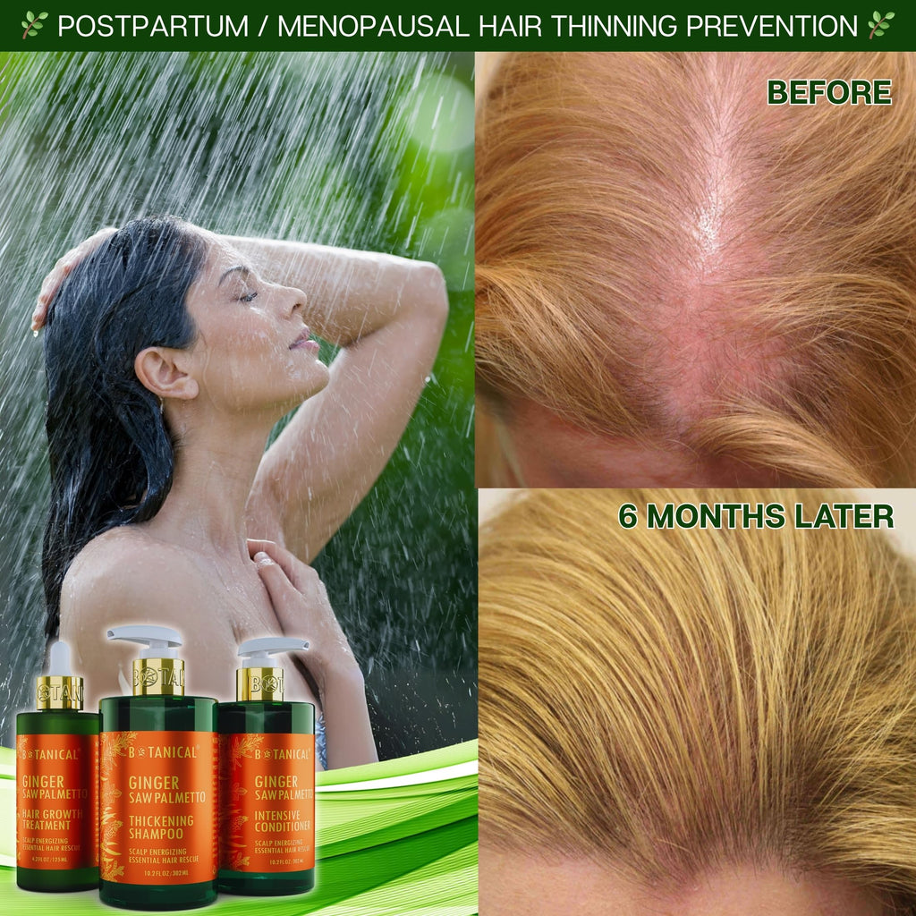 Botanical Hair Growth Lab Ginger Shampoo with Saw Palmetto – Scalp Energizing Thickening, 10.2 fl oz