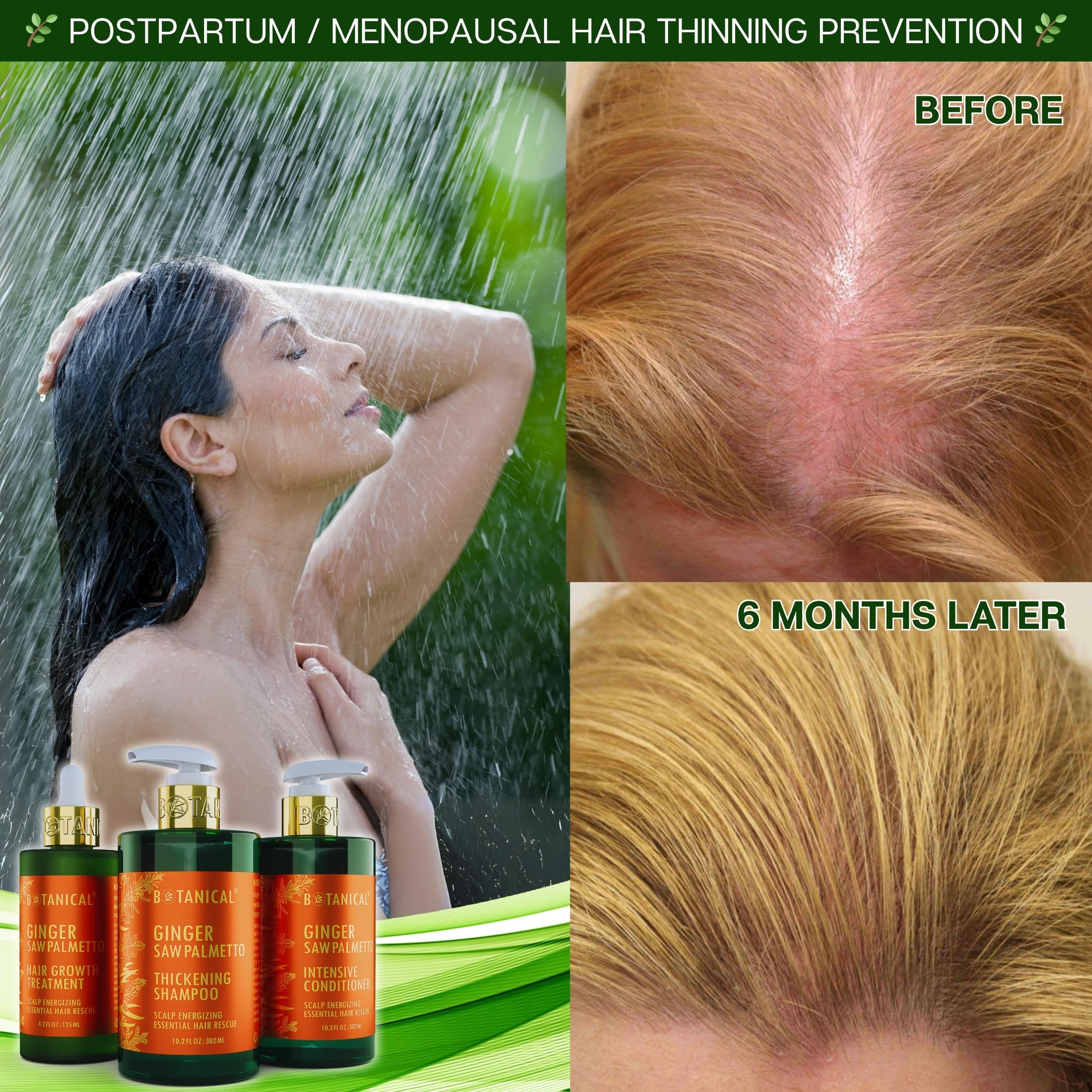 Botanical Hair Growth Lab Ginger Shampoo with Saw Palmetto – Scalp Energizing Thickening, 10.2 fl oz