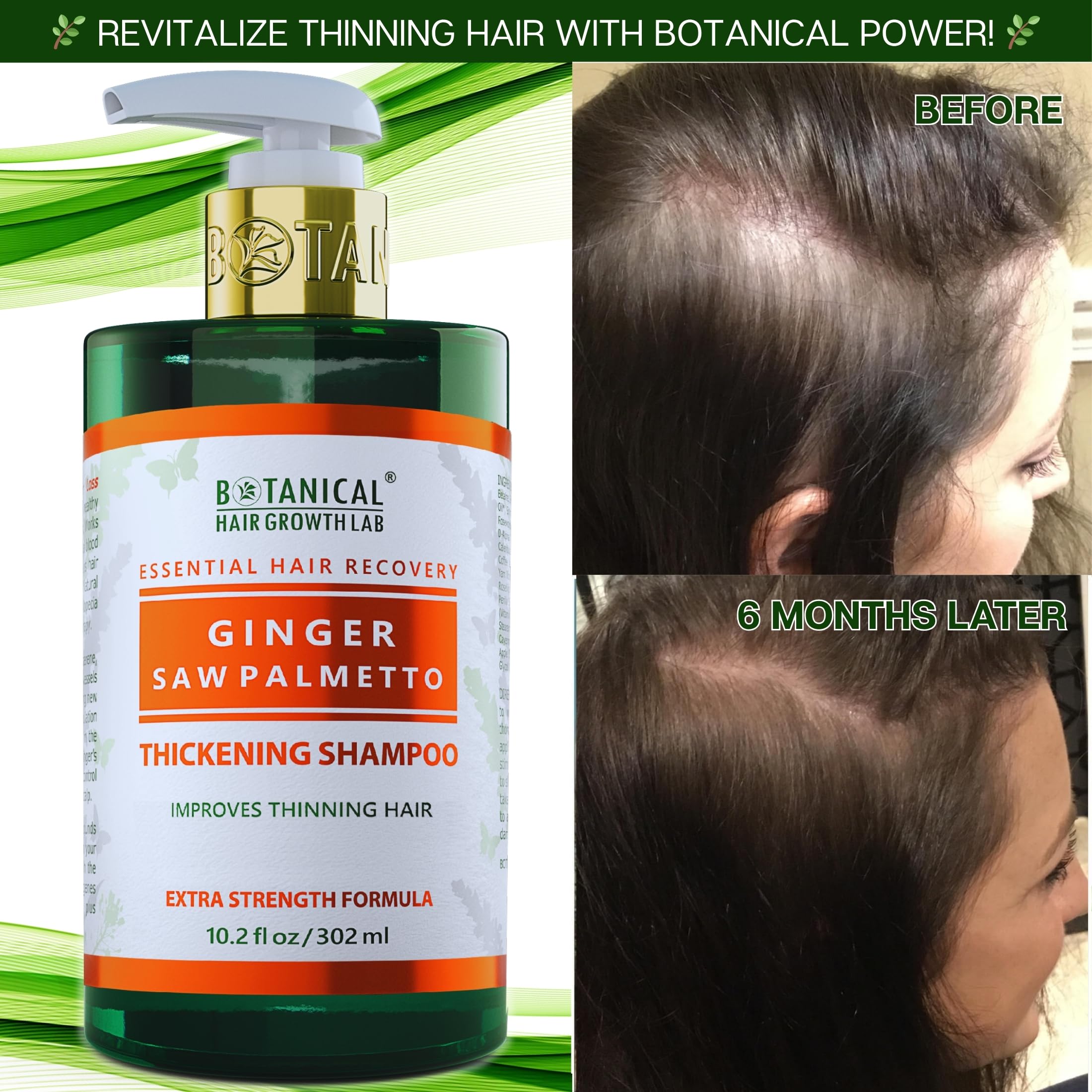 Botanical Hair Growth Shampoo with Ginger & Saw Palmetto – Thickening & Scalp Stimulation (10.2 fl oz) | BOTANICAL HAIR GROWTH LAB