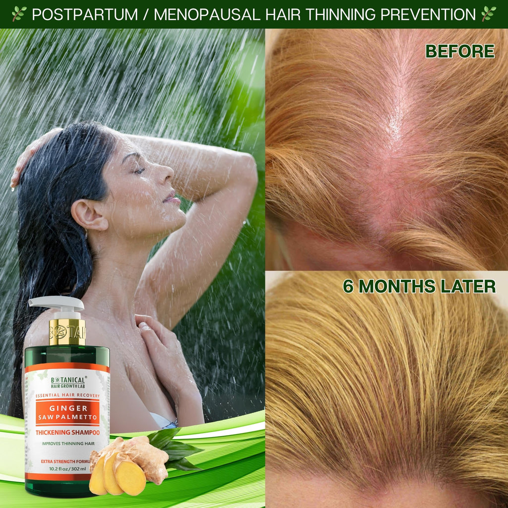 Botanical Hair Growth Shampoo with Ginger & Saw Palmetto – Thickening & Scalp Stimulation (10.2 fl oz) | BOTANICAL HAIR GROWTH LAB