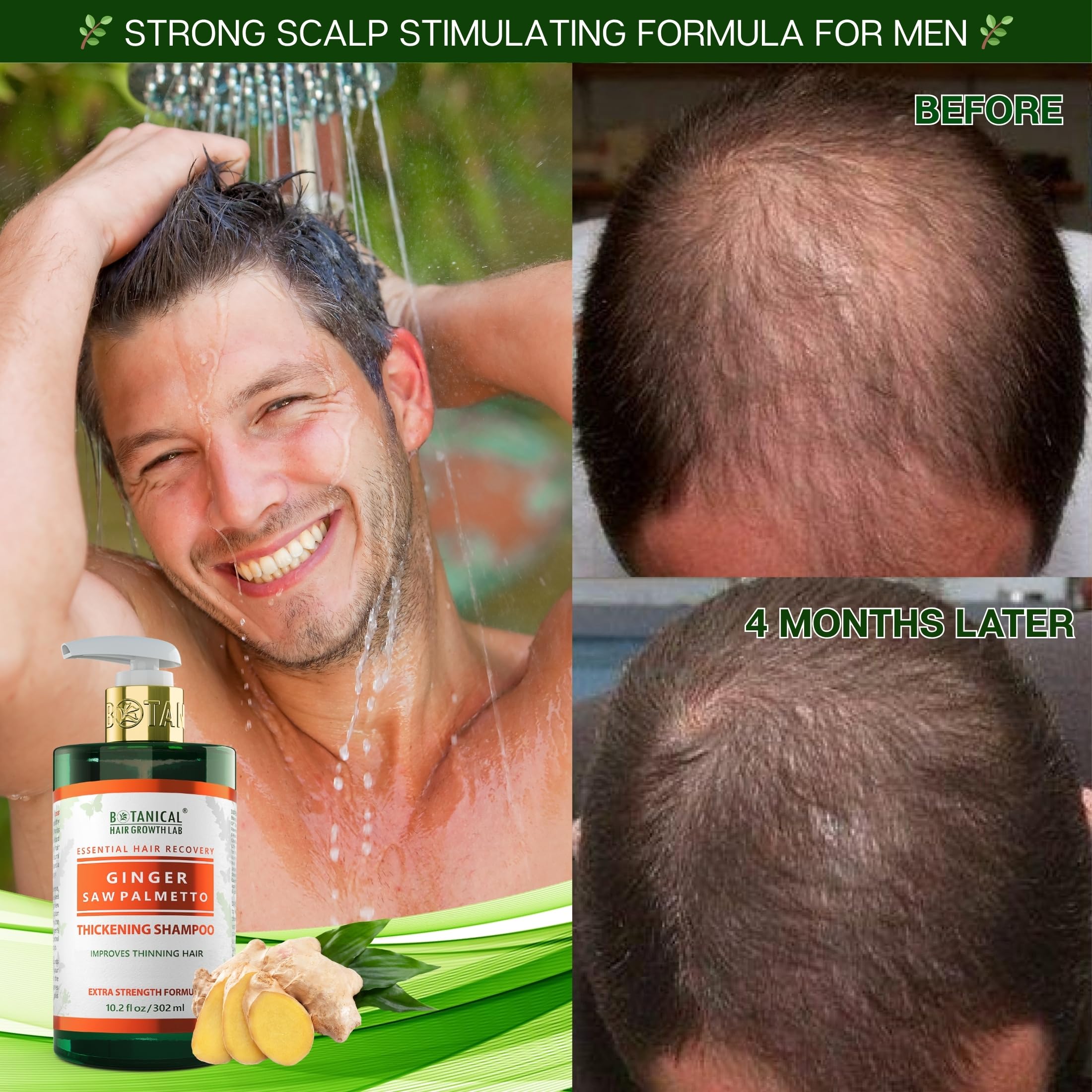 Botanical Hair Growth Shampoo with Ginger & Saw Palmetto – Thickening & Scalp Stimulation (10.2 fl oz) | BOTANICAL HAIR GROWTH LAB