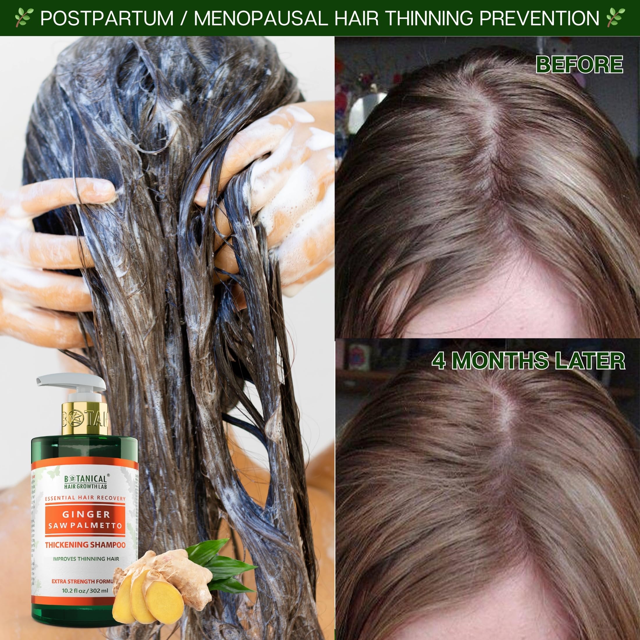 Botanical Hair Growth Shampoo with Ginger & Saw Palmetto – Thickening & Scalp Stimulation (10.2 fl oz) | BOTANICAL HAIR GROWTH LAB