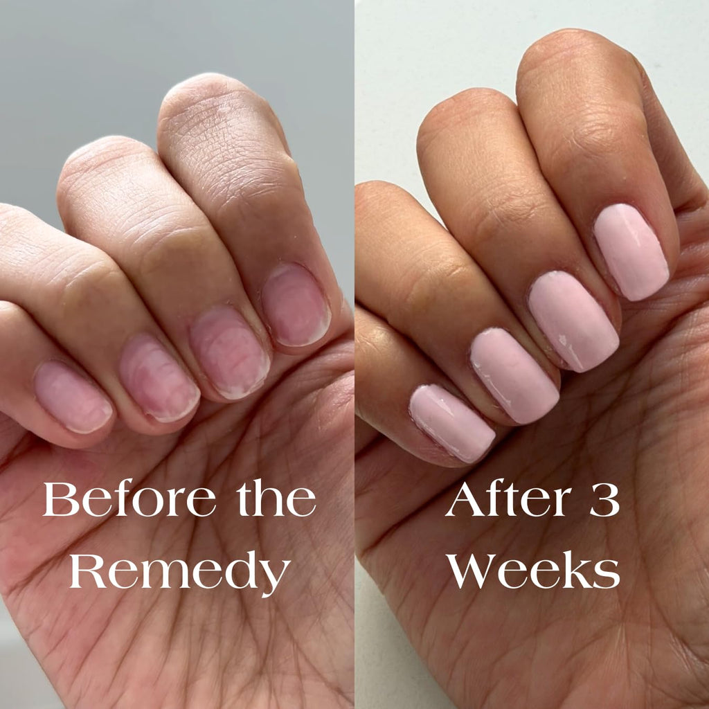 Botanist The Remedy | Plant-Based Nail Strengthening Polish (Cherry Blossom) – 84% Plant-Based, 21-Free & Vegan