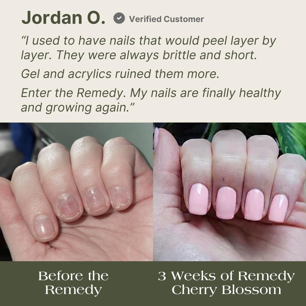 Botanist The Remedy | Plant-Based Nail Strengthening Polish (Cherry Blossom) – 84% Plant-Based, 21-Free & Vegan