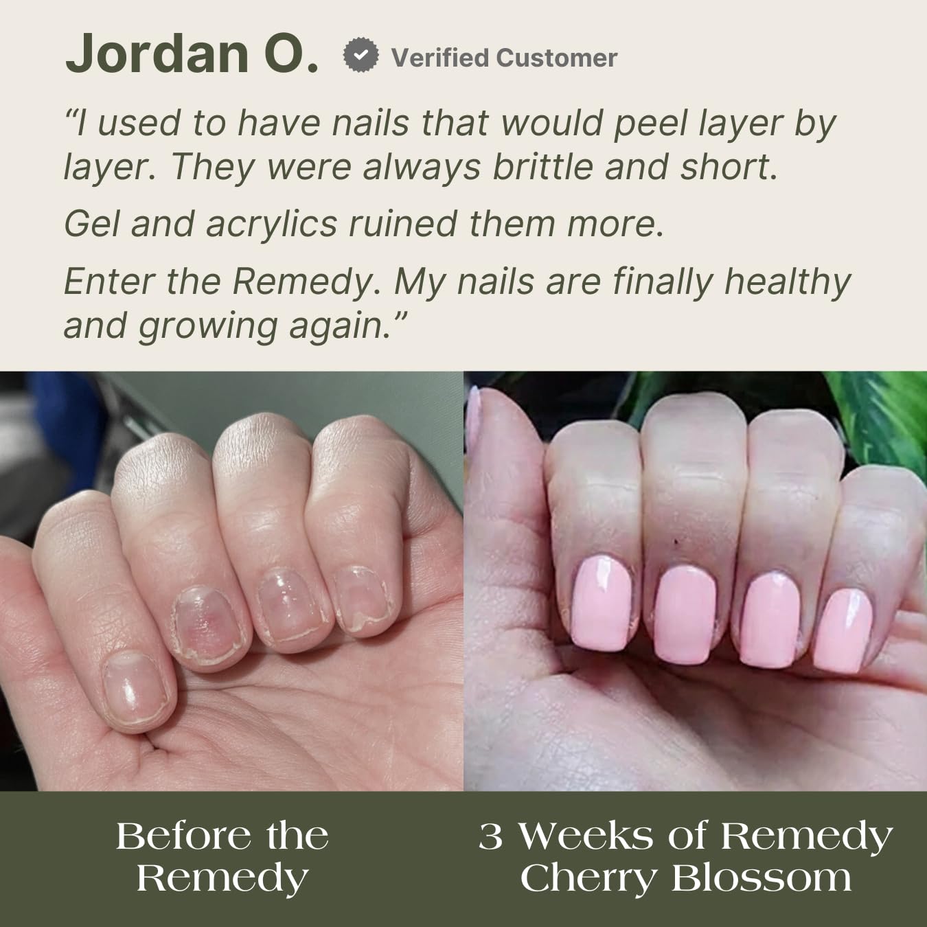 Botanist The Remedy | Plant-Based Nail Strengthening Polish (Cherry Blossom) – 84% Plant-Based, 21-Free & Vegan
