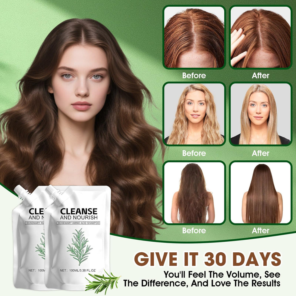 Botou 2PCS Rosemary Amino Acid Shampoo – Hair Growth & Strengthening for Thinning Hair (3.38 fl oz)