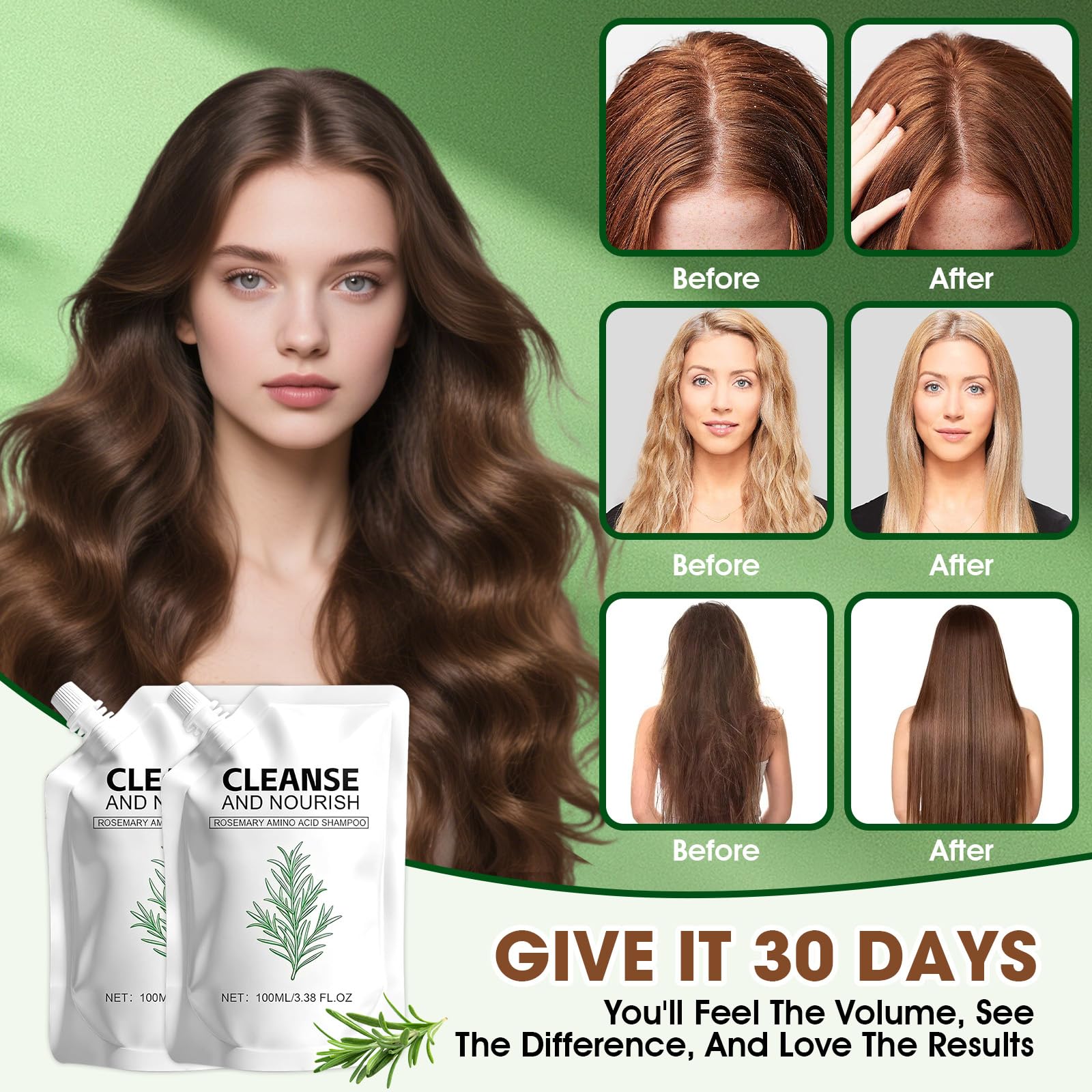 Botou 2PCS Rosemary Amino Acid Shampoo – Hair Growth & Strengthening for Thinning Hair (3.38 fl oz)