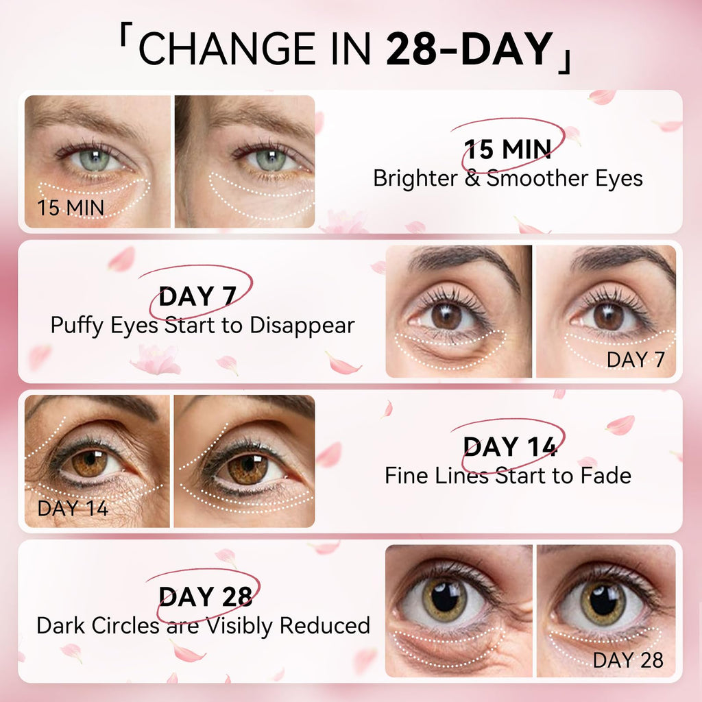 BREYLEE Flamingo Pink Eye Mask – 60 Patches for Puffy Eyes, Dark Circles & Fine Lines