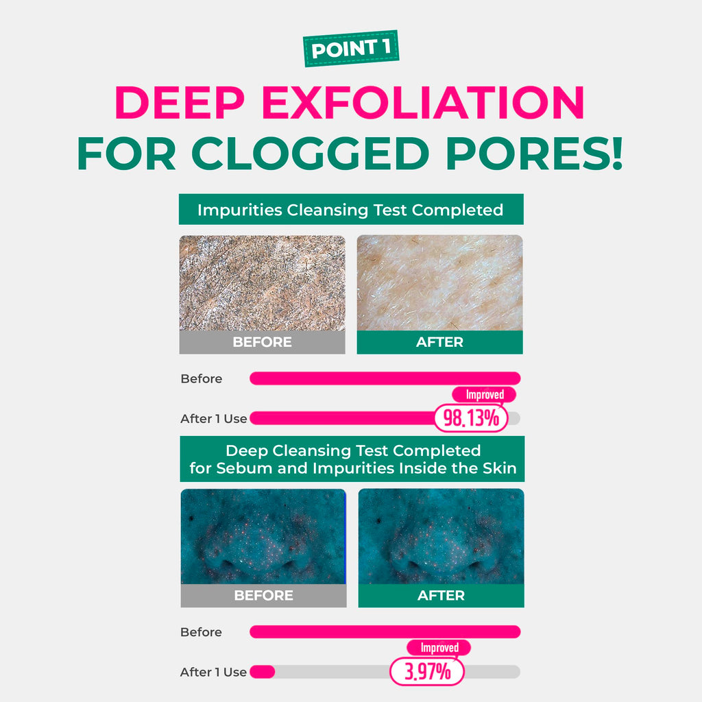 BRING GREEN Netflix Squid Game Edition Tea Tree Cica Pore Clay Pack 100g – Deep Cleansing & Cooling Mask