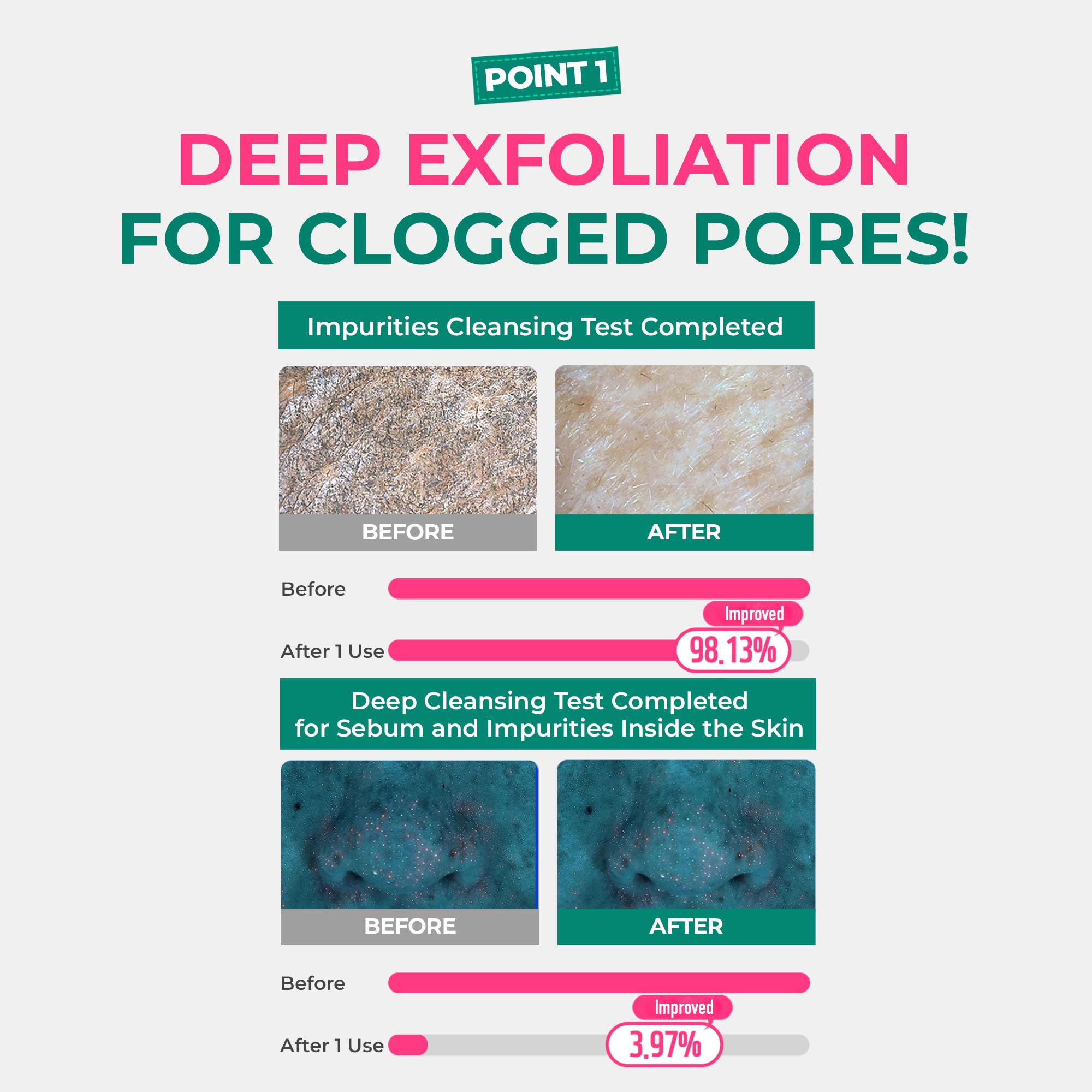 BRING GREEN Netflix Squid Game Edition Tea Tree Cica Pore Clay Pack 100g – Deep Cleansing & Cooling Mask
