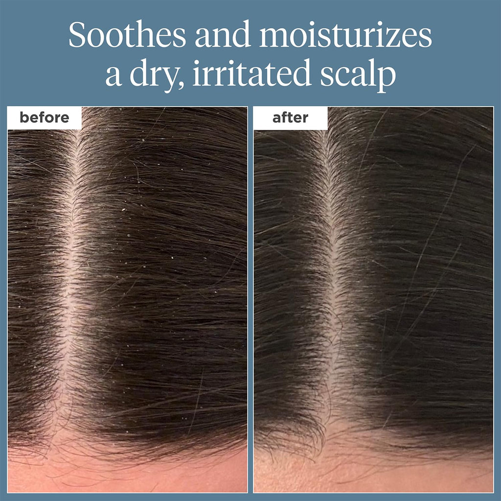 Briogeo Scalp Revival Rosemary Pre-Wash Oil for Hair & Scalp