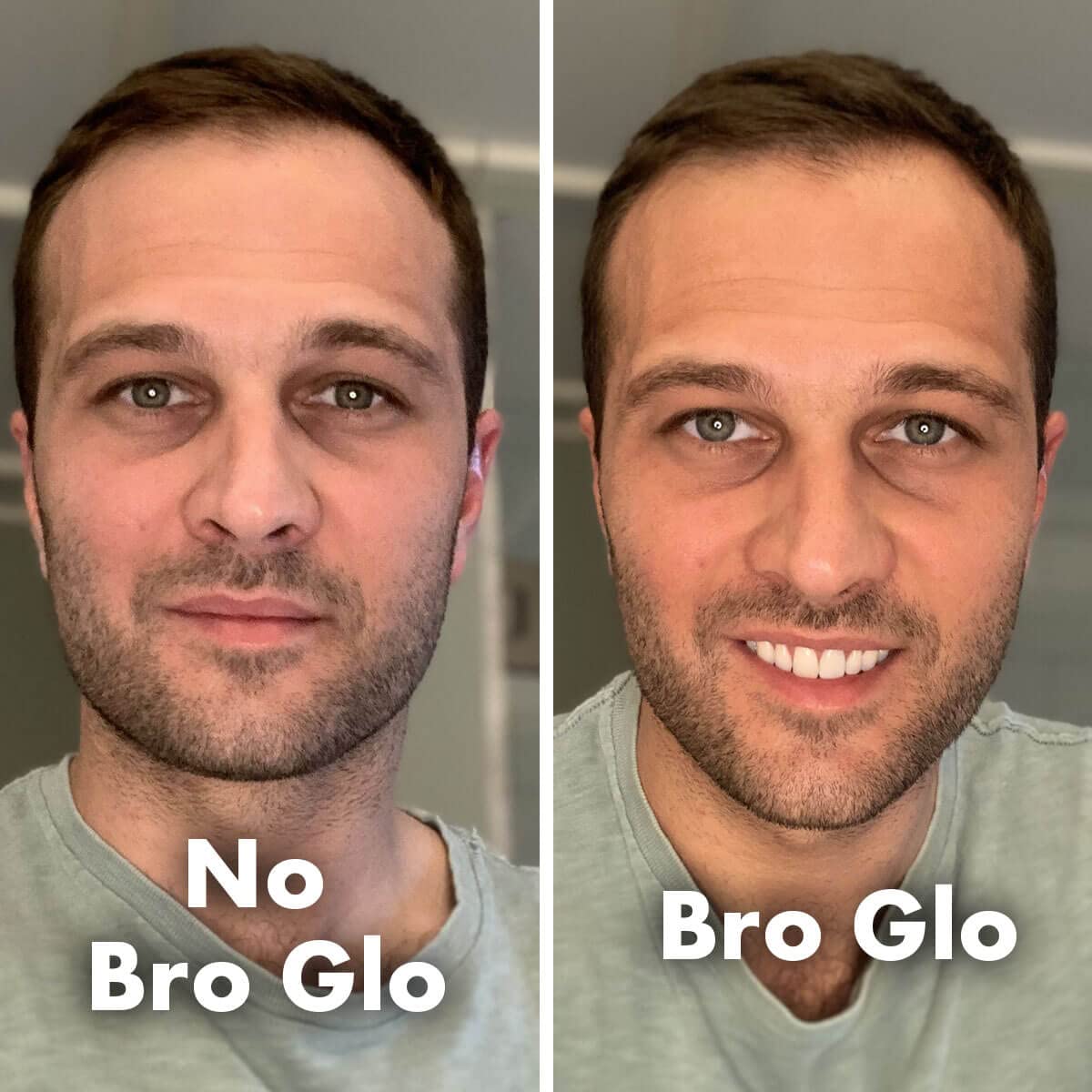 Bro Glo King Bundle Self Tanner for The Boys – Oil-Free, Water-Based