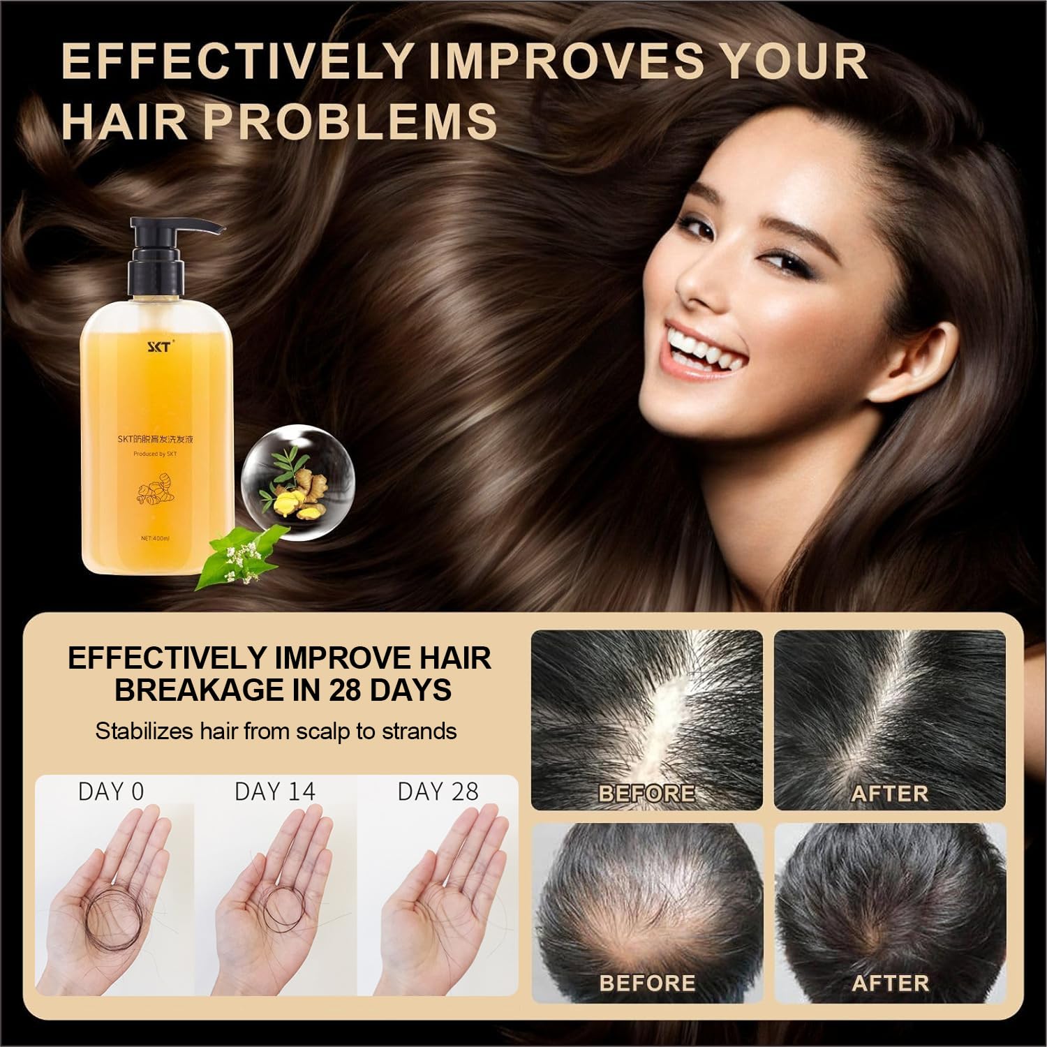 BSMAX Ginger Plant Extract Anti Hair Loss Shampoo | Hair Regrowth, Thickening & Longer Hair (400ml)