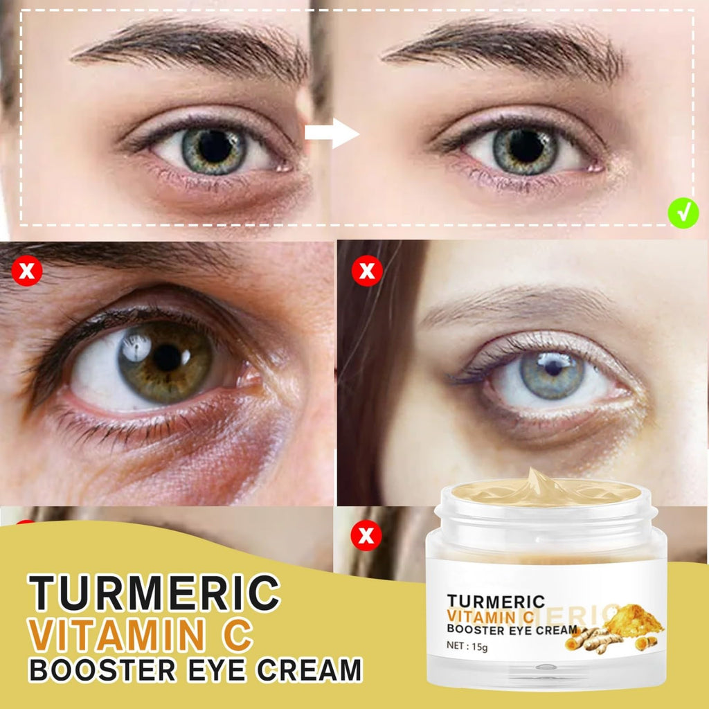 BSMKCL Turmeric + Vitamin C Eye Cream – Dark Circles, Puffiness & Fine Lines