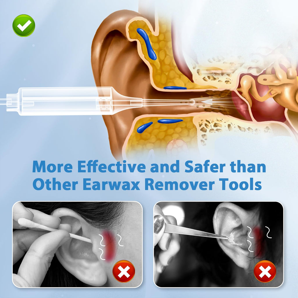 B.urHero Ear Vacuum Remover — 3-Level Suction, Rechargeable Ear Wax Removal Kit