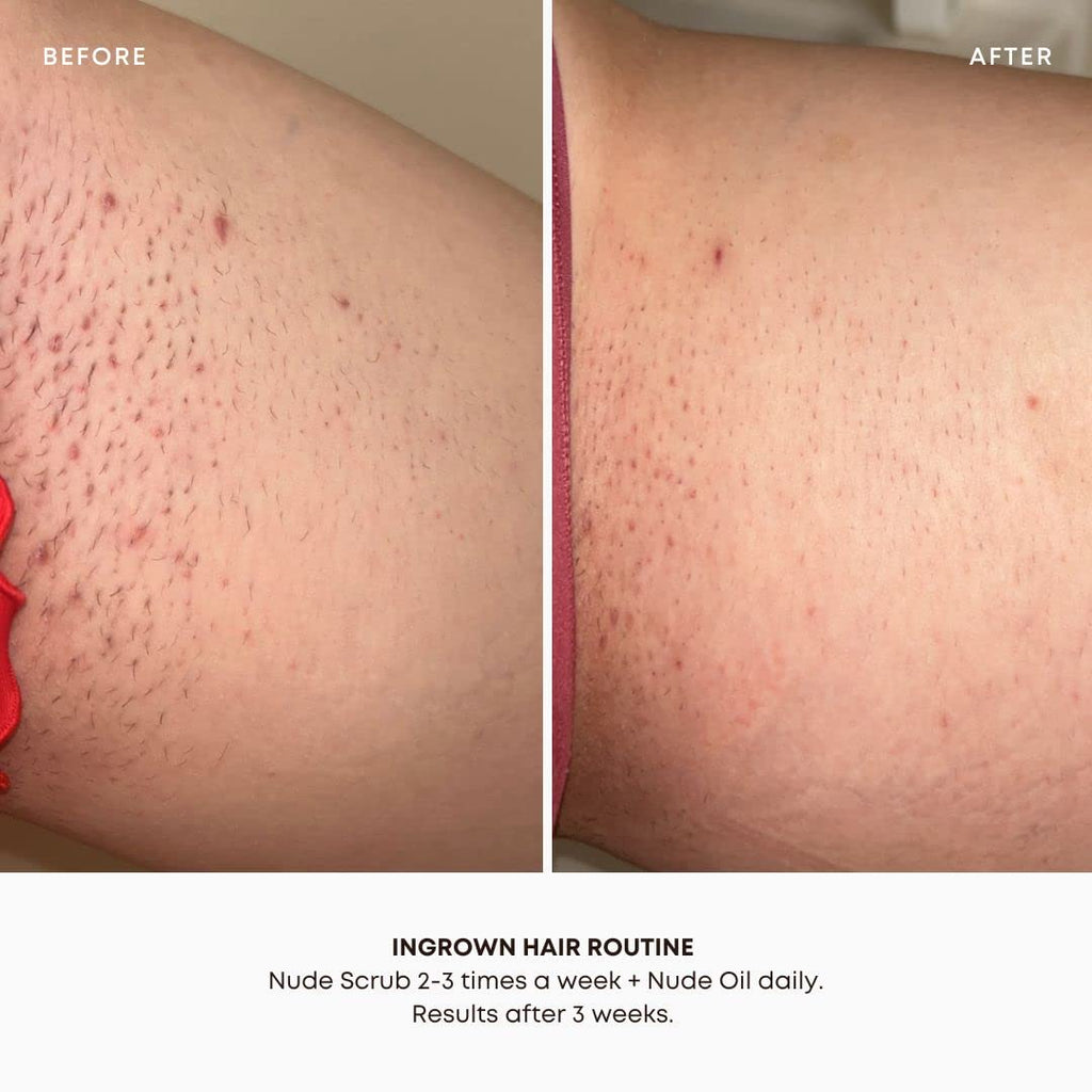 Bushbalm Nude 2-Step Routine: Ingrown Hair Oil + Exfoliating Scrub