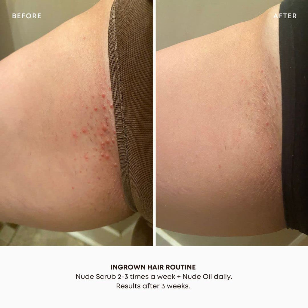 Bushbalm Nude 2-Step Routine: Ingrown Hair Oil + Exfoliating Scrub