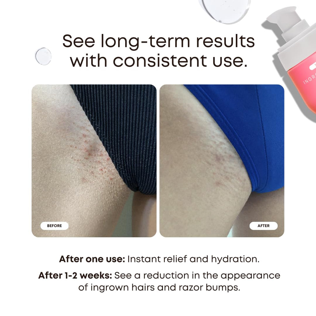 Bushbalm Ingrown Hair & Razor Bumps Routine – Watermelon Sugar (Oil 30 ml + Scrub 236 ml)