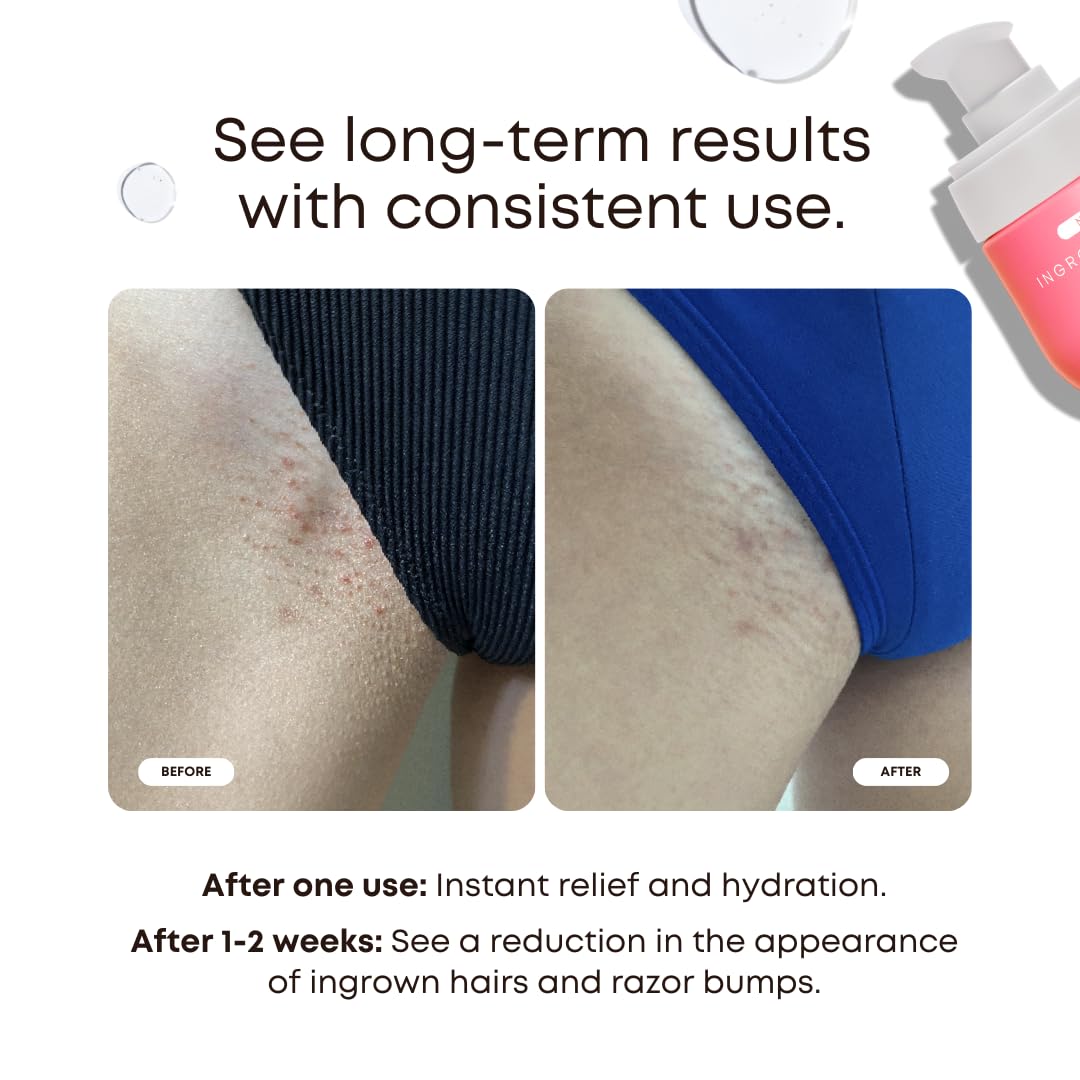 Bushbalm Ingrown Hair & Razor Bumps Routine – Watermelon Sugar (Oil 30 ml + Scrub 236 ml)