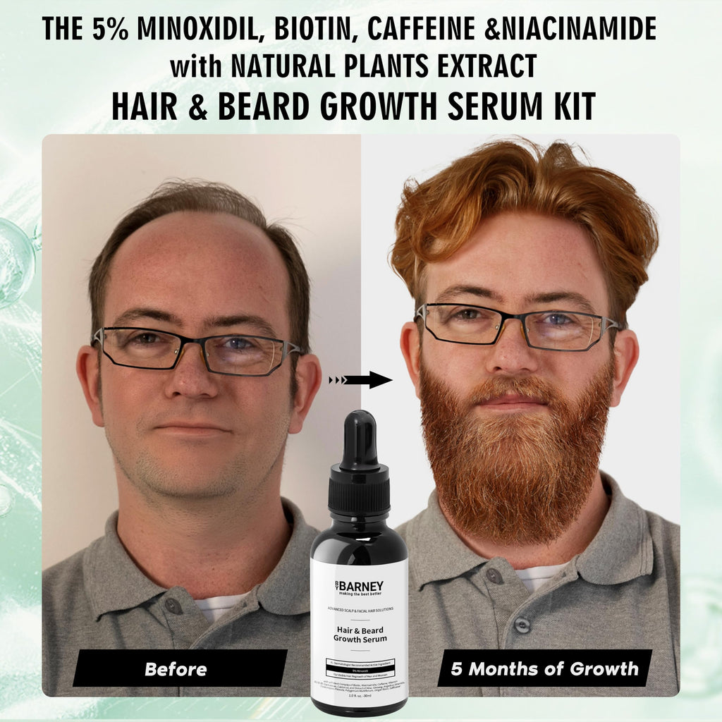 BY BARNEY 5% Minoxidil Hair & Beard Growth Serum – Natural Extracts, Biotin & Caffeine
