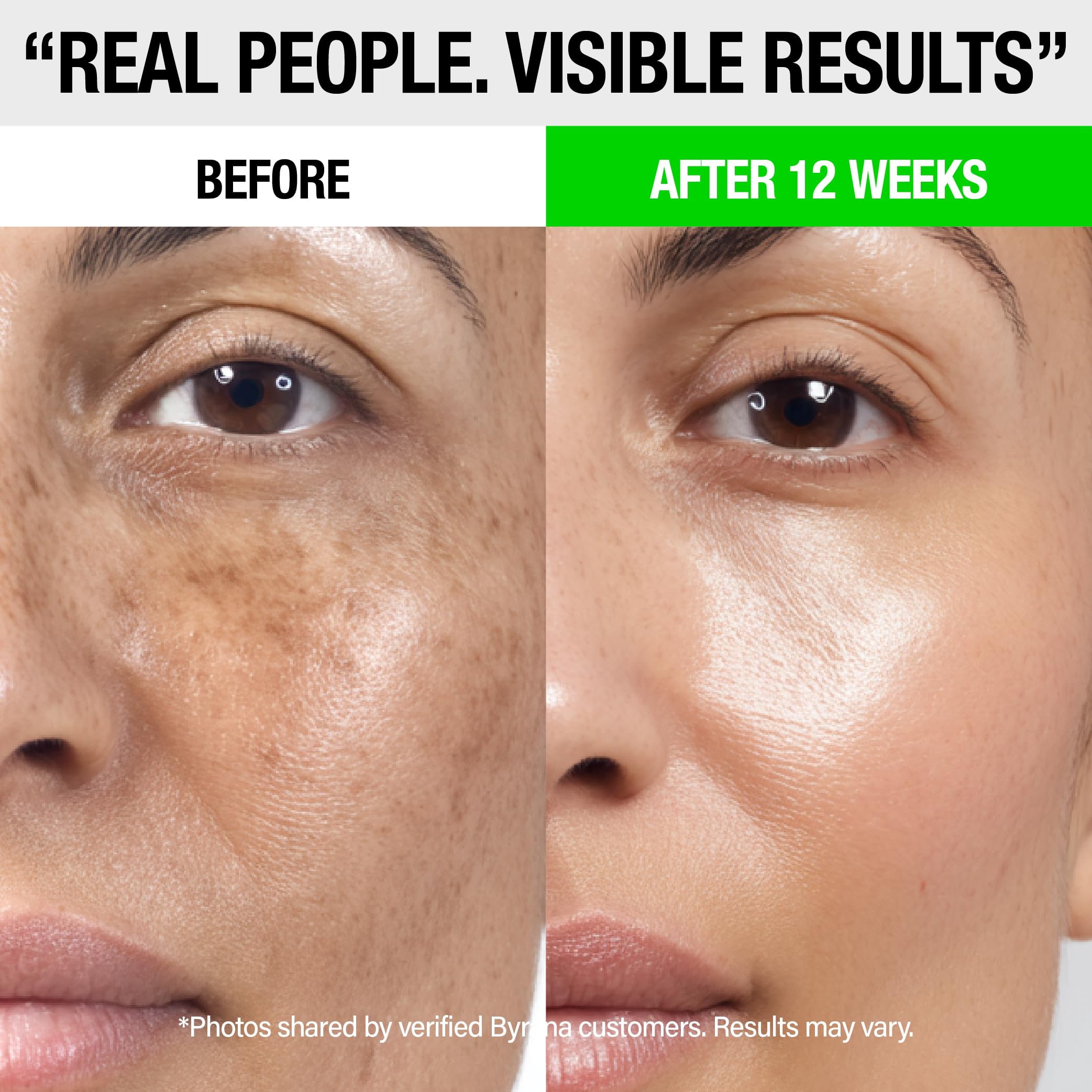 BYRANA Dark Spot Clarity Oil Serum with Vitamin C – Uneven Tone & Post-Acne Marks