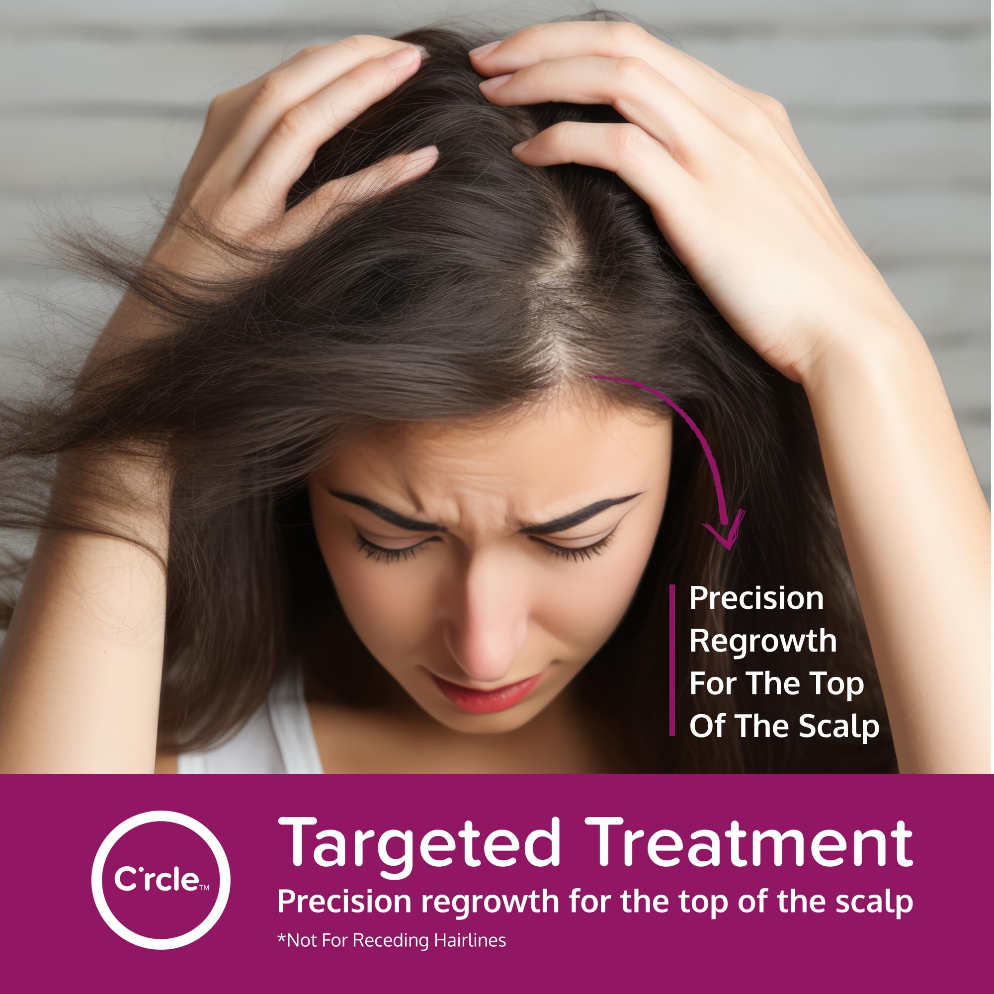 C'rcle 5% Minoxidil Foam for Women — Eight-Month Crown Hair Regrowth