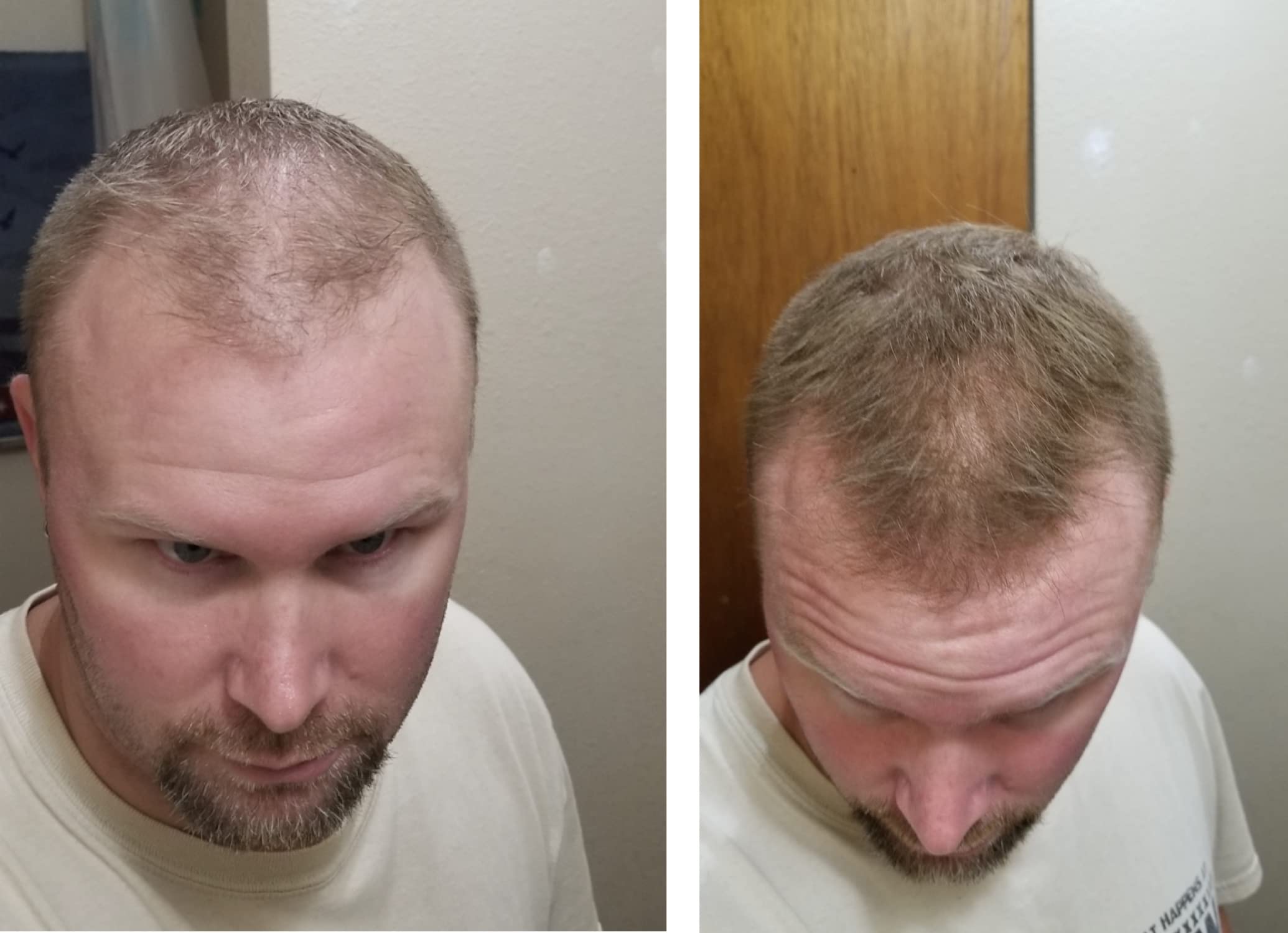 Caboki Hair Loss Concealer – Instantly Look 10x Fuller, Cover Bald Spots (30G, 90-Day Supply) Light Brown