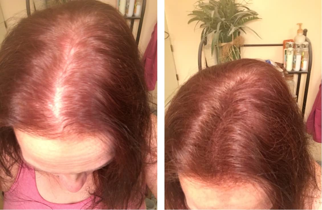 Caboki Hair Loss Concealer - All-Natural Plant-Based Fibers for Instant Fuller Hair (Light Auburn, 30g)