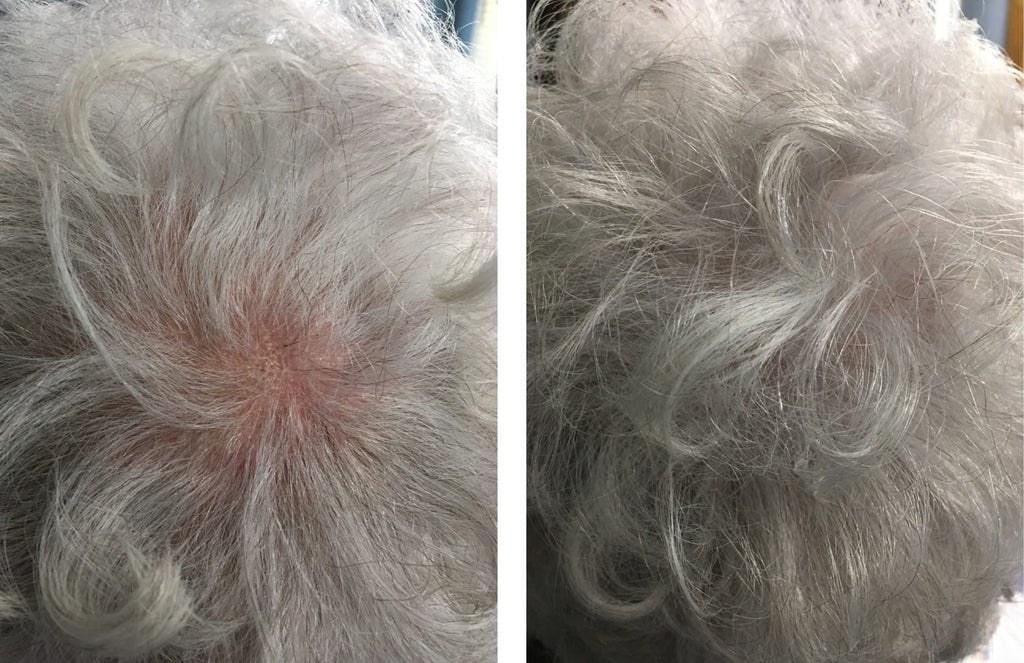 Caboki Hair Loss Concealer — All-Natural Fibers for Instant Fuller Hair (30g, 90-Day Supply) Silver/White