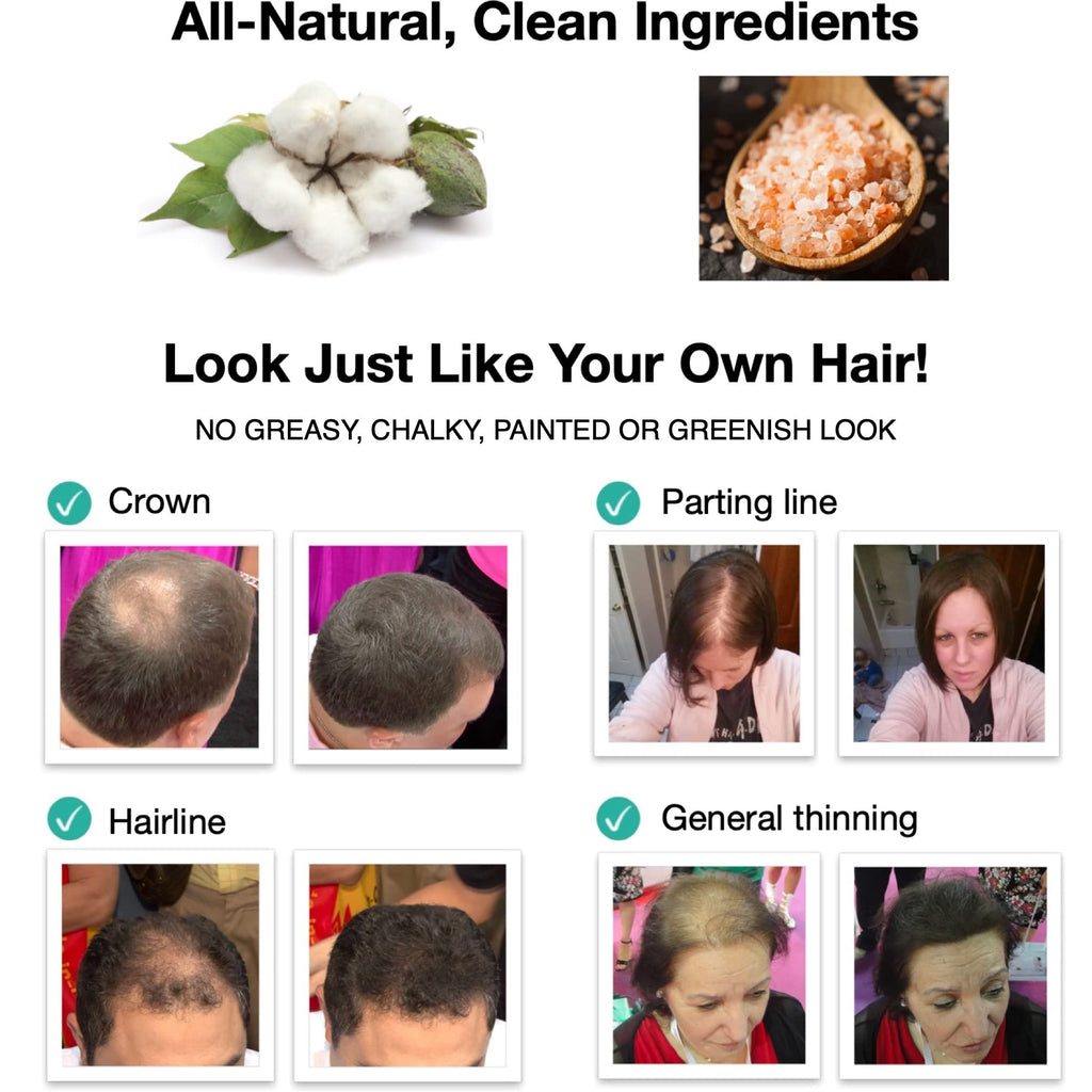 Caboki Hair Loss Concealer — All-Natural Fibers for Instant Fuller Hair (30g, 90-Day Supply) Silver/White
