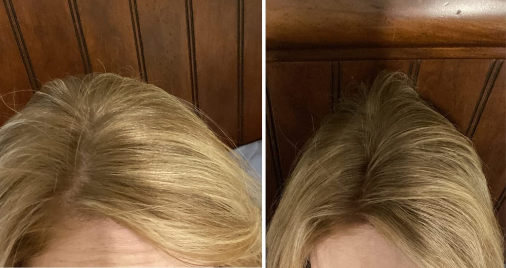 Caboki Hair Loss Concealer – All-Natural Plant Fibers for Instant Fuller Look (Natural Blonde, 30g)