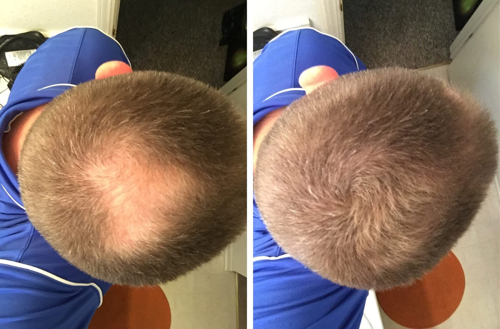 Caboki Hair Loss Concealer – Instantly Look 10x Fuller, Cover Bald Spots (30G, 90-Day Supply) Light Brown