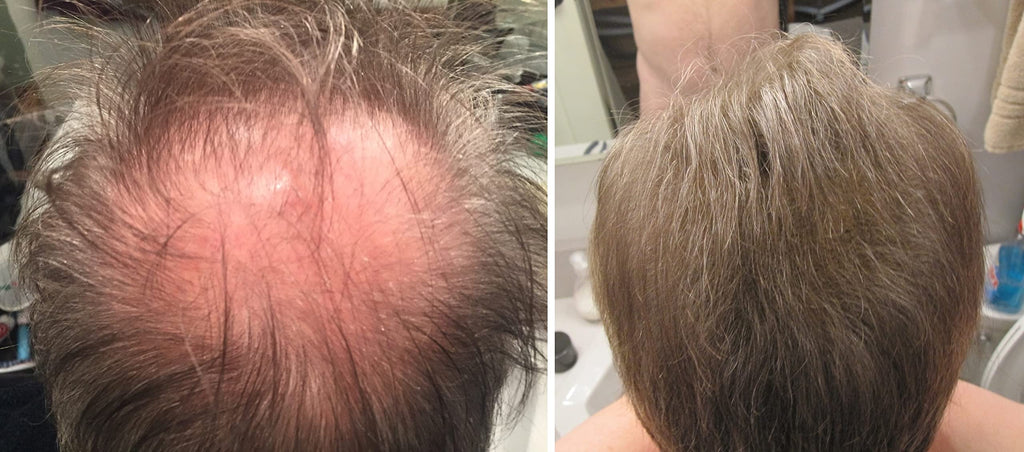 Caboki Hair Loss Concealer – Instantly Look 10x Fuller, Cover Bald Spots (30G, 90-Day Supply) Light Brown