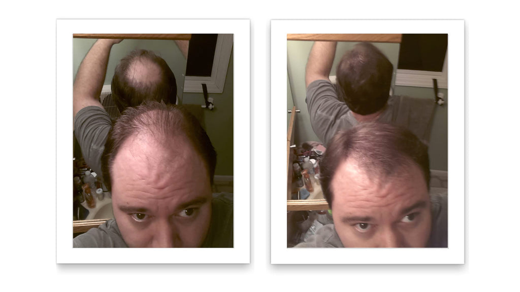 Caboki Hair Loss Concealer – Instantly Look 10x Fuller, Cover Bald Spots (30G, 90-Day Supply) Light Brown