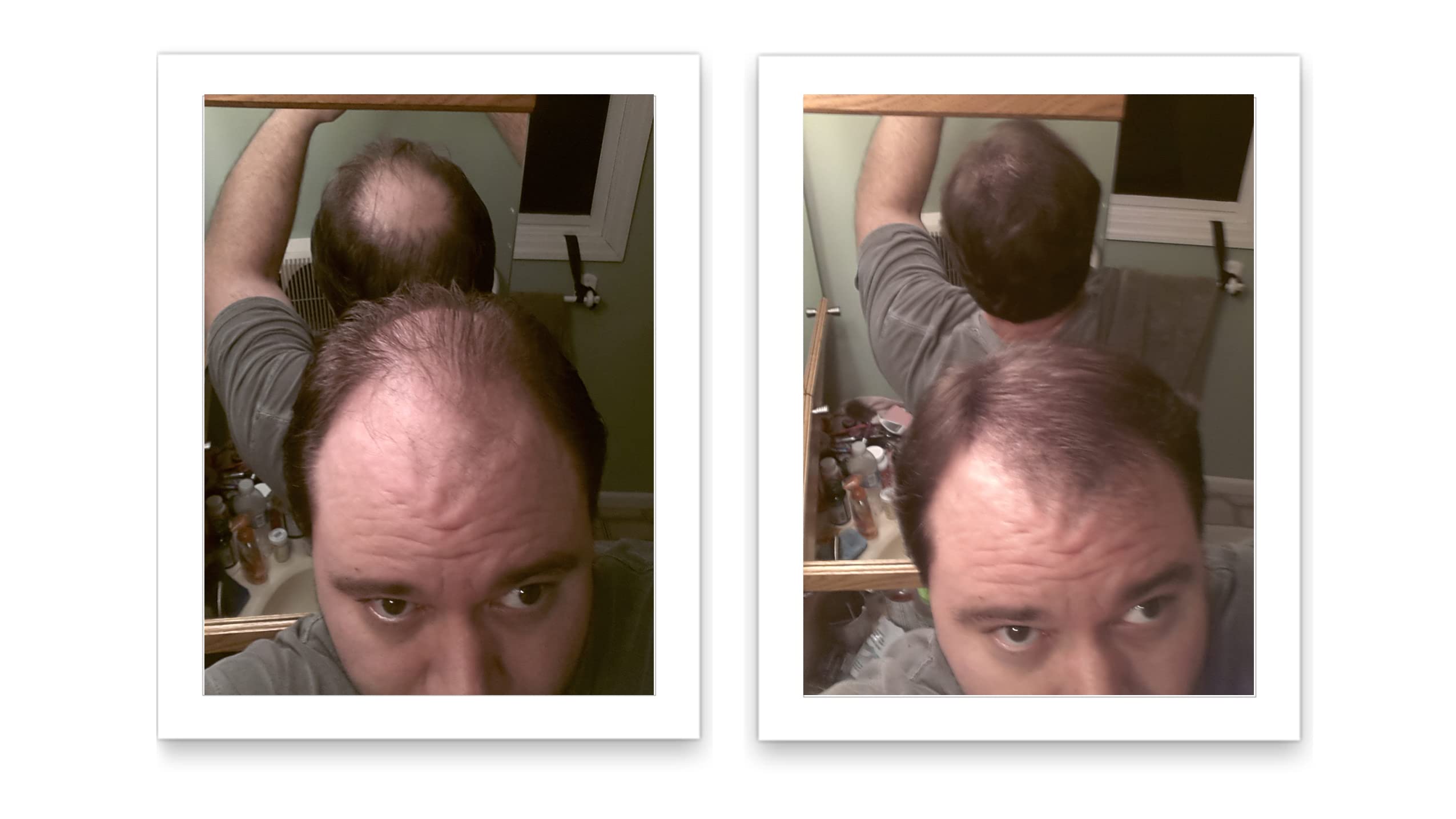 Caboki Hair Loss Concealer – Instantly Look 10x Fuller, Cover Bald Spots (30G, 90-Day Supply) Light Brown