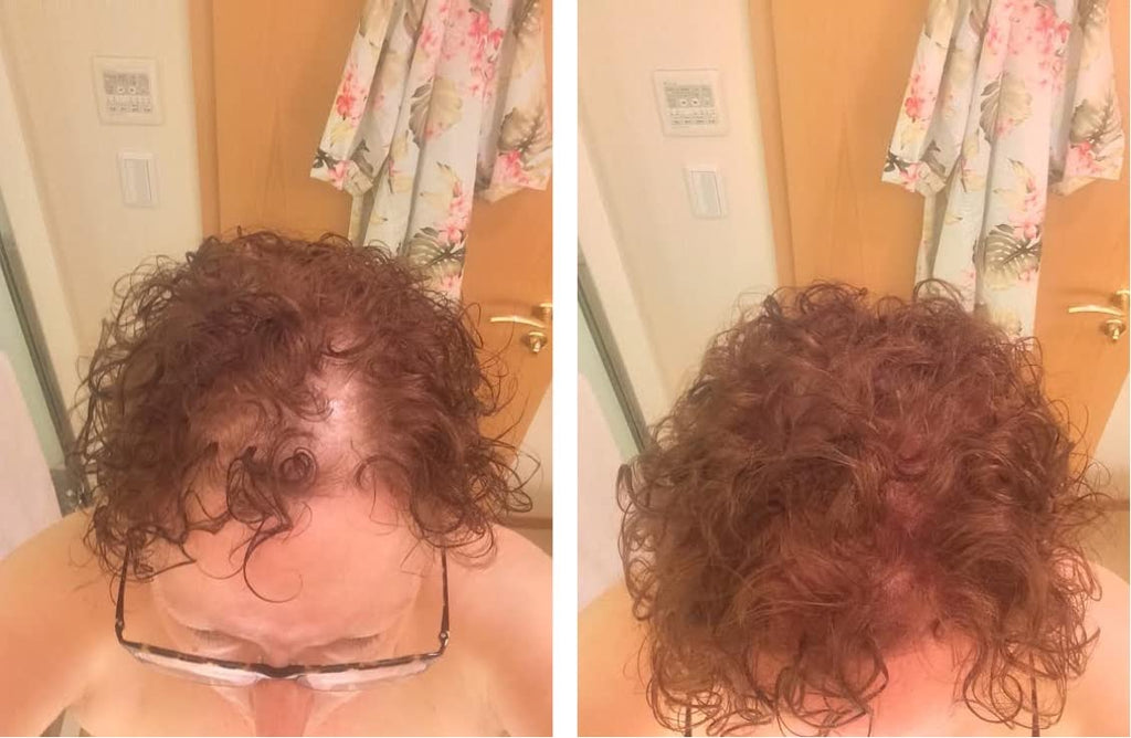 Caboki Hair Loss Concealer - All-Natural Plant-Based Fibers for Instant Fuller Hair (Light Auburn, 30g)