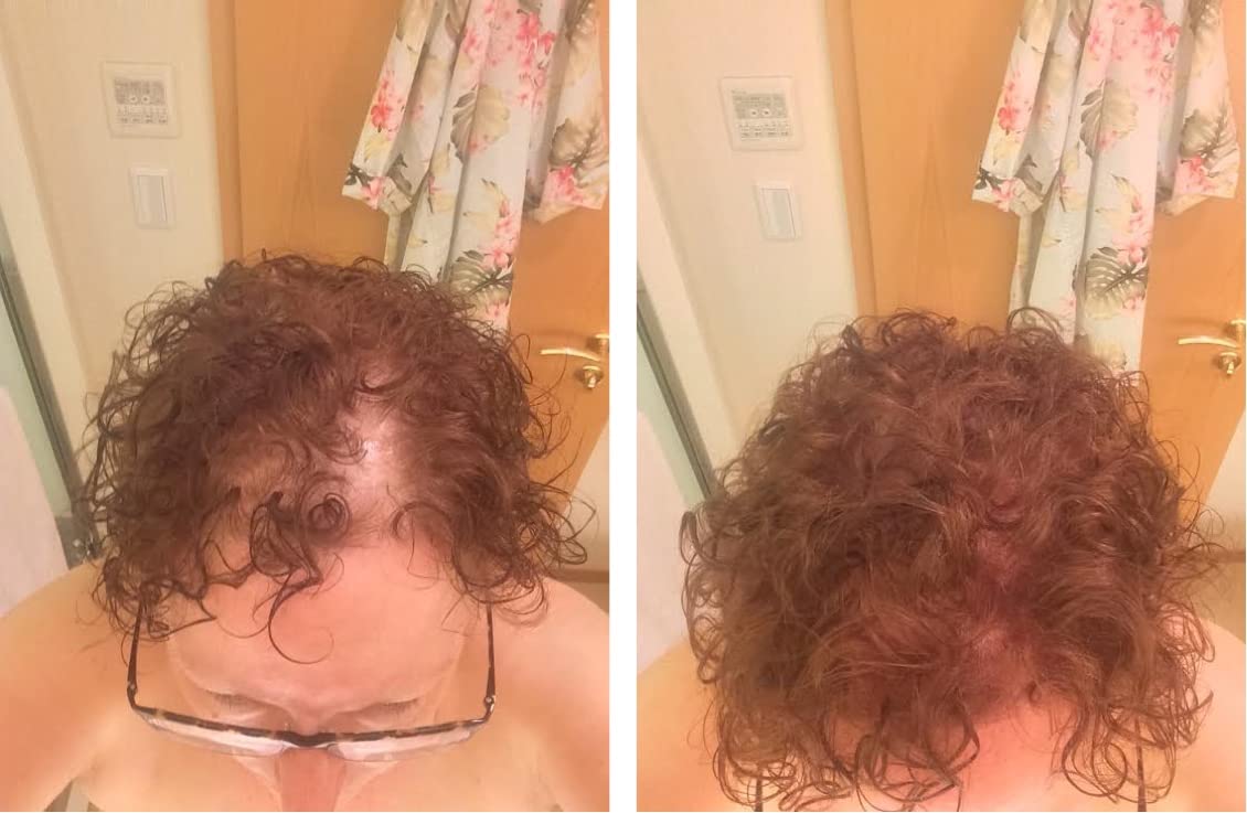 Caboki Hair Loss Concealer - All-Natural Plant-Based Fibers for Instant Fuller Hair (Light Auburn, 30g)