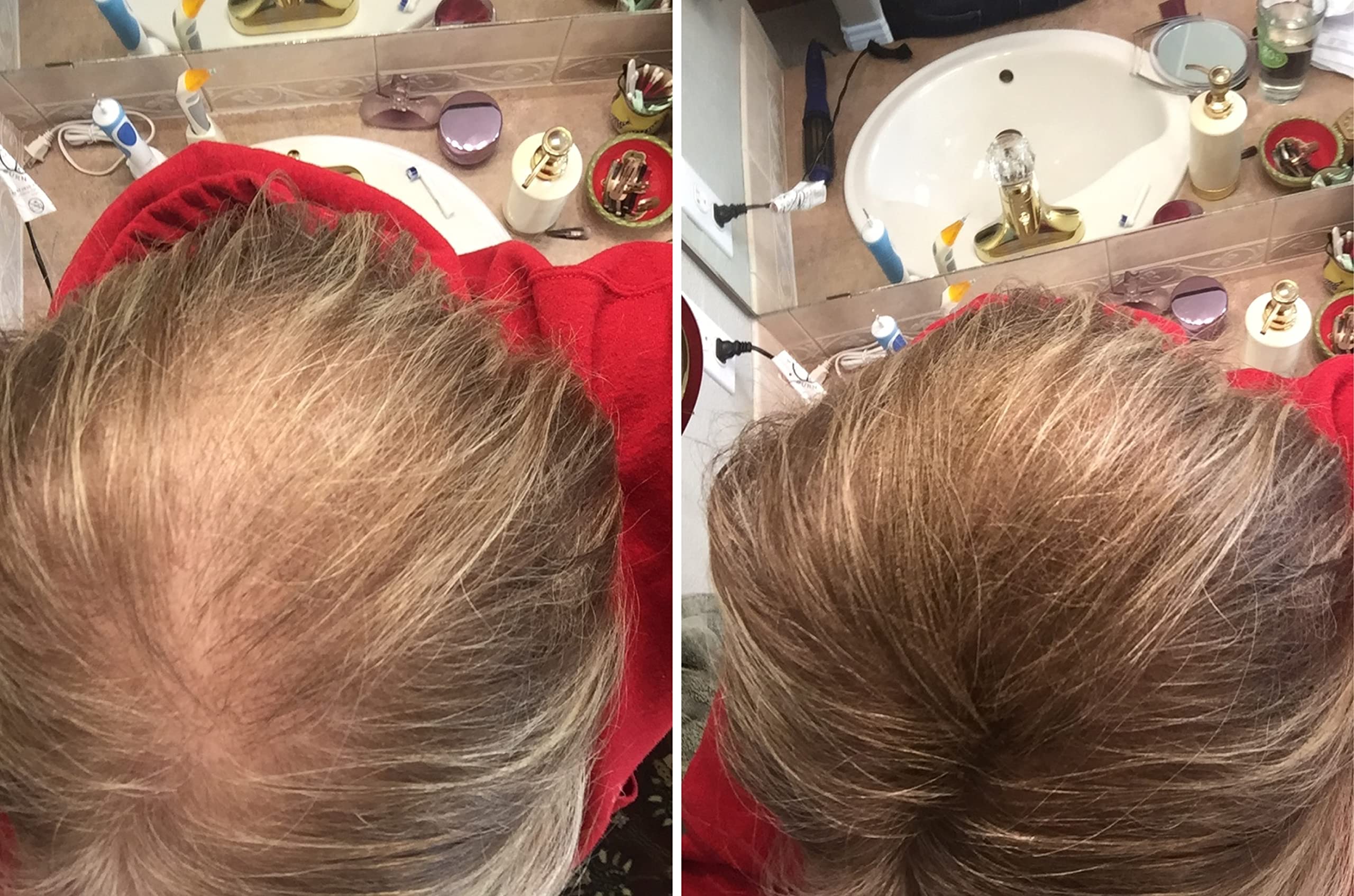 Caboki Hair Loss Concealer – Instantly Look 10x Fuller, Cover Bald Spots (30G, 90-Day Supply) Light Brown
