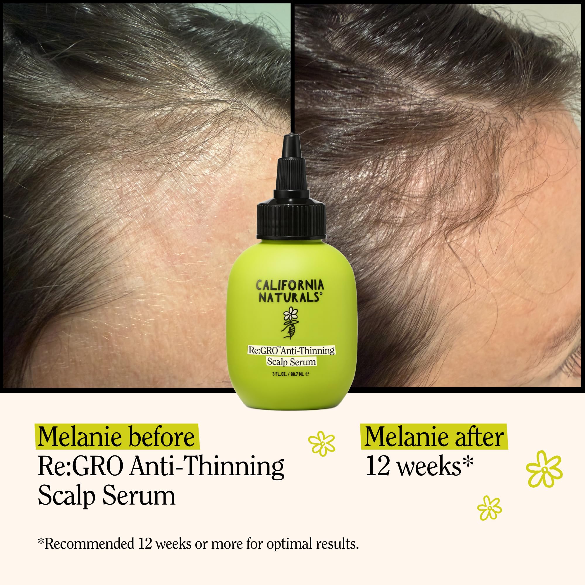 California Naturals Re:GRO Anti-Thinning Scalp Serum – 5% Capixyl, 3oz