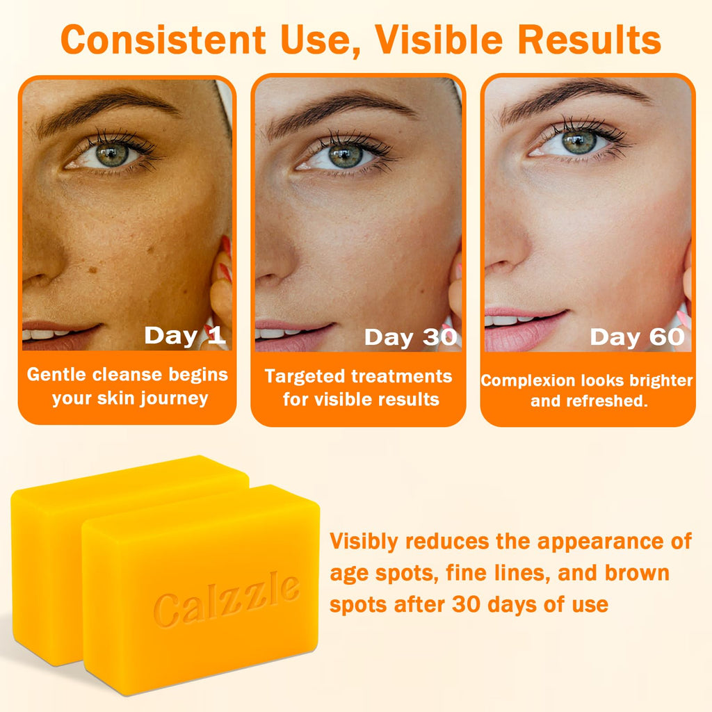 Calzzle Kojic Acid Soap 4PCS – Brightening with Turmeric, Vitamin C & Retinol