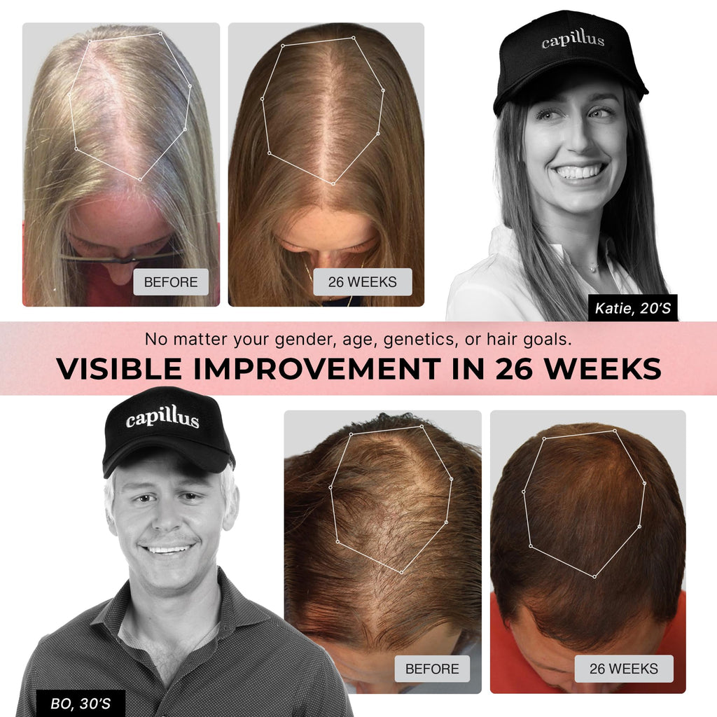 Capillus PRO Red Light Cap for Hair Regrowth — 272 Lasers, FDA Cleared, Bluetooth
