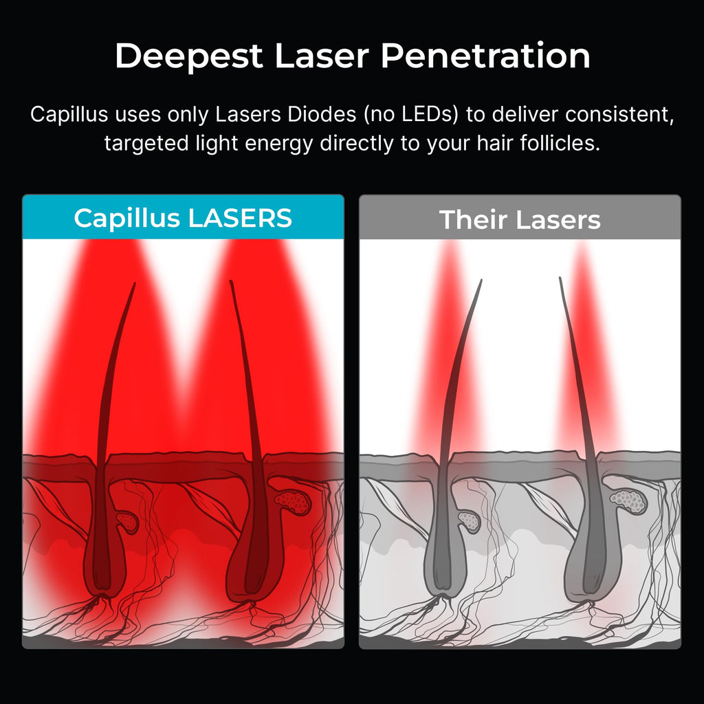 Capillus Pro S2 Red Light Cap for Hair Regrowth | 308 Laser LLLT Hat
