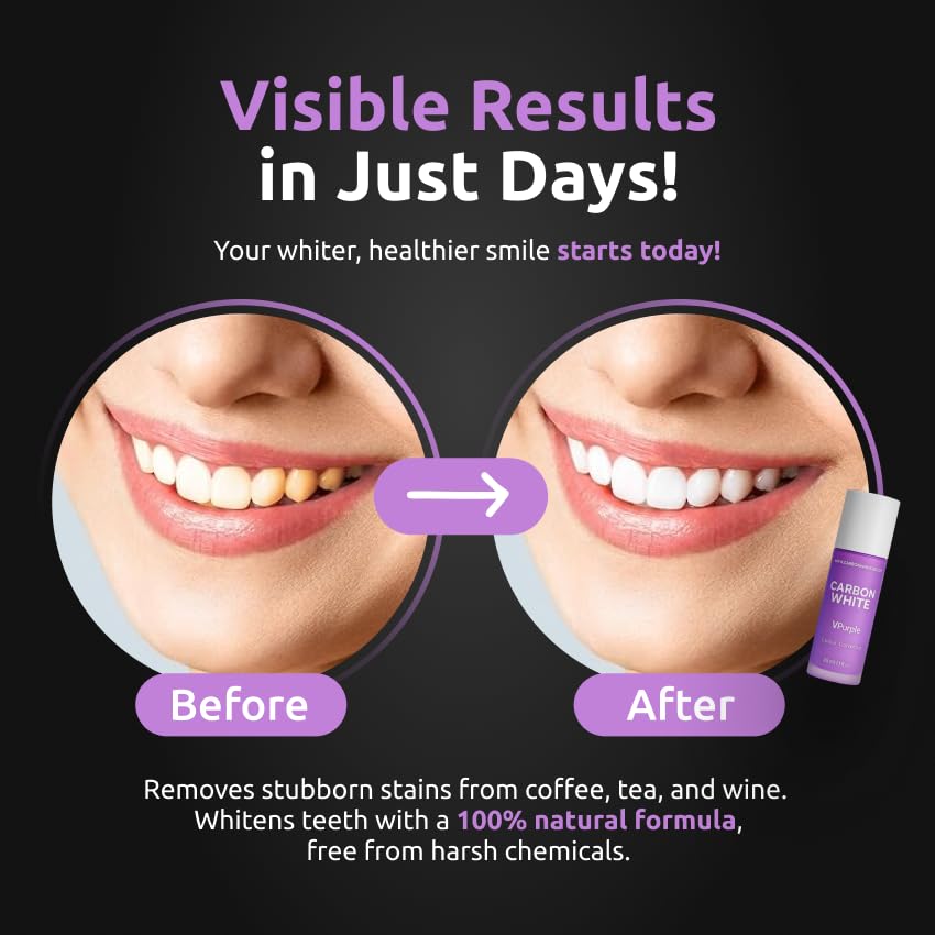 Carbon White VPurple Colour Corrector – Purple Toothpaste for Instant Brightening, Peroxide-Free, Safe for Daily Use (30ml)
