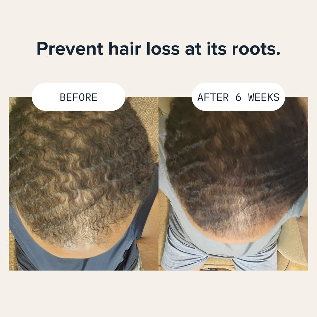Cardon Hair Growth Shampoo for Men – Thickening & Scalp Care