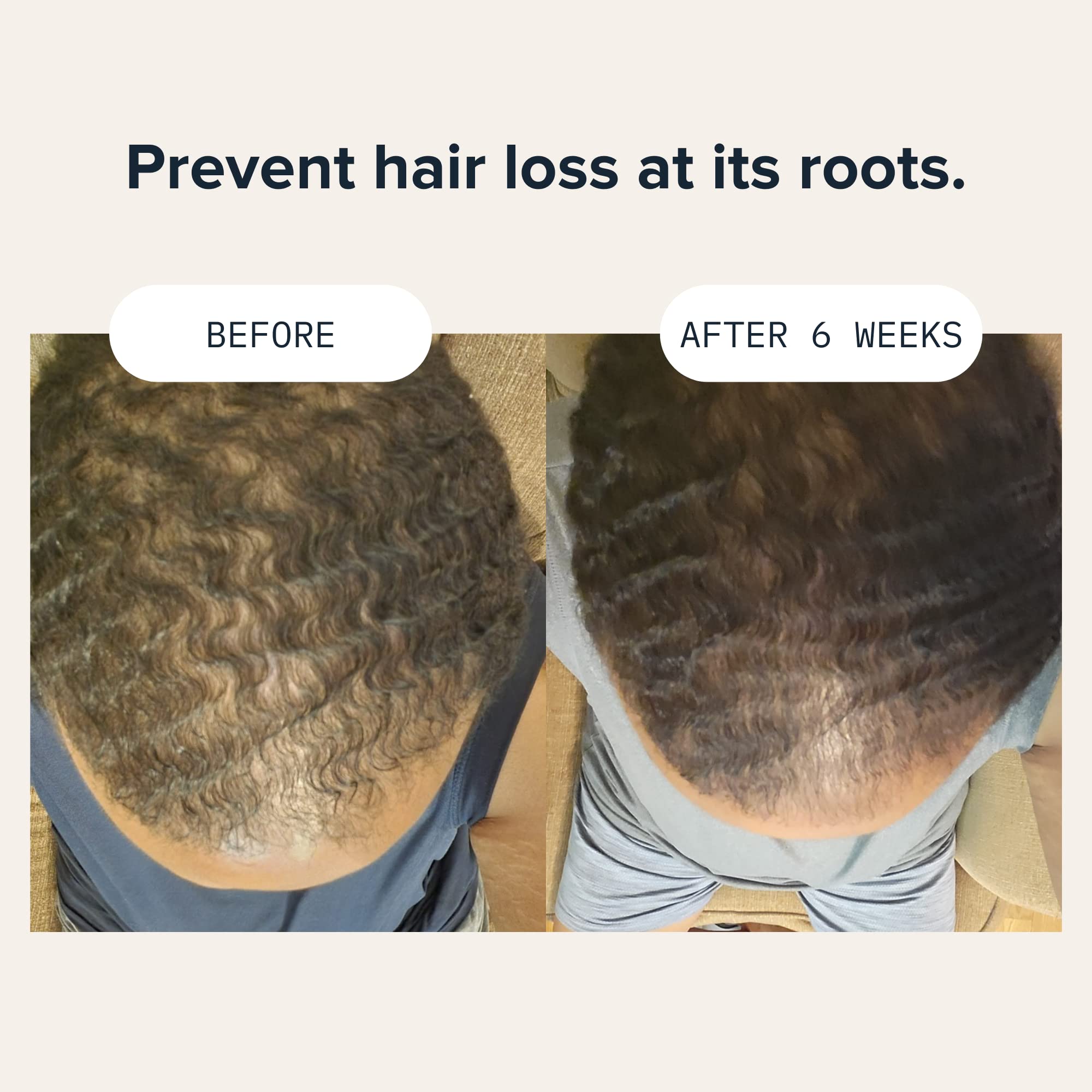 Cardon Hair Growth Shampoo for Men – Thickening & Scalp Care