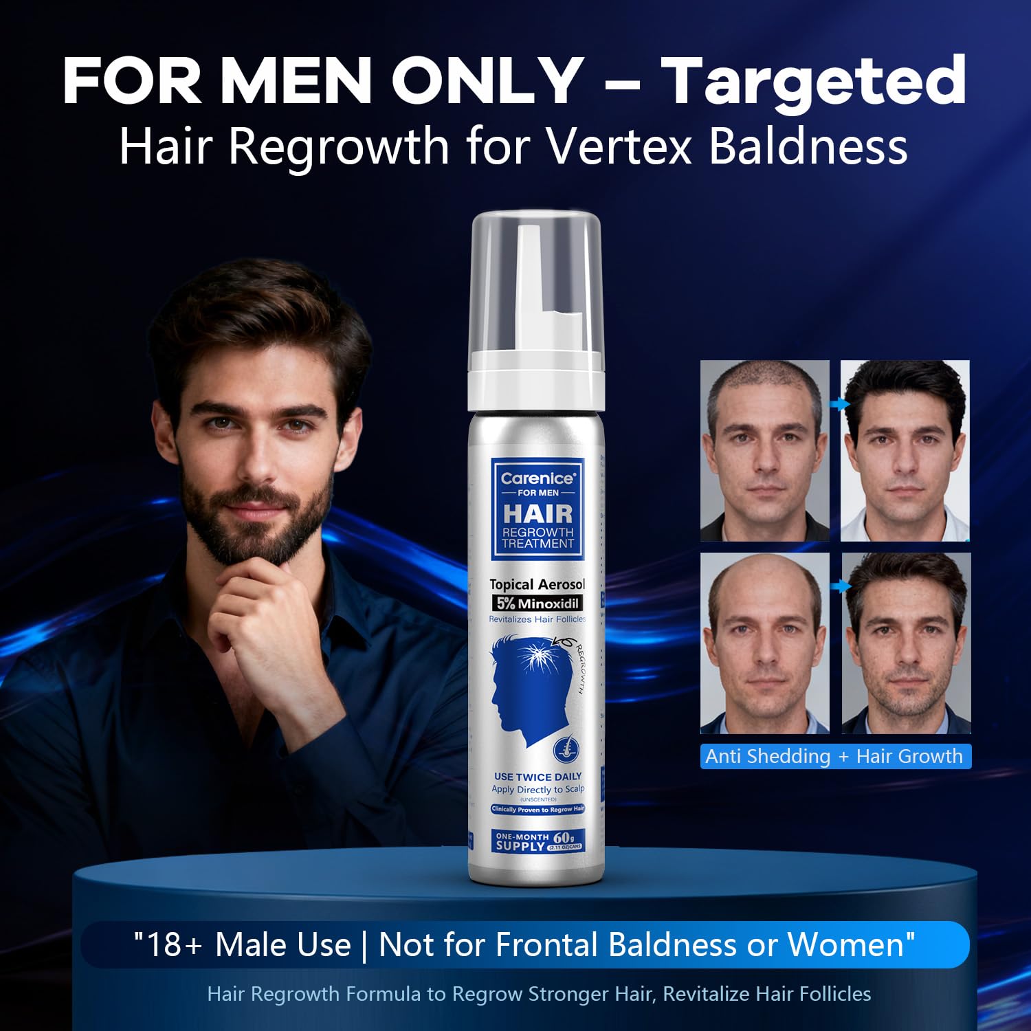 CARENICE 5% Minoxidil Foam for Men with Biotin – Unscented Hair & Beard Growth (6.33 oz)