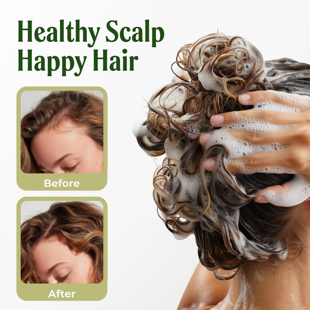 CAROLAYAGE Rosemary Shampoo – Hair Growth & Strength | Red Onion, Biotin & Rosemary