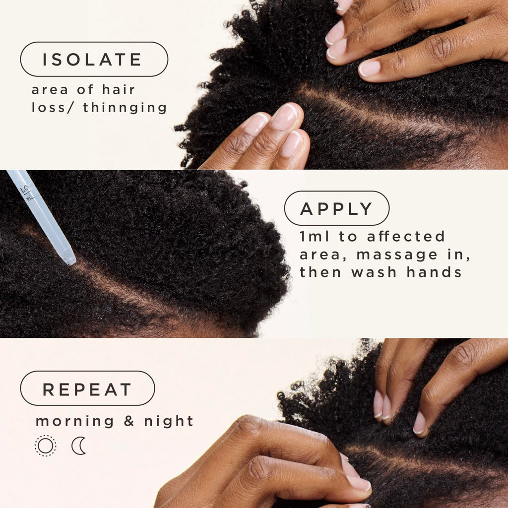 Carol's Daughter Goddess Strength Hair Regrowth Treatment for Women, 2% Minoxidil, 2 oz