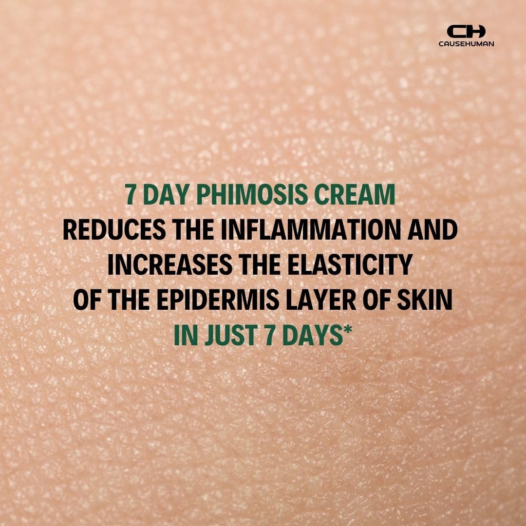 Cause Human 7-Day Phimosis Cream – Steroid-Free Relief at Home (90 g)