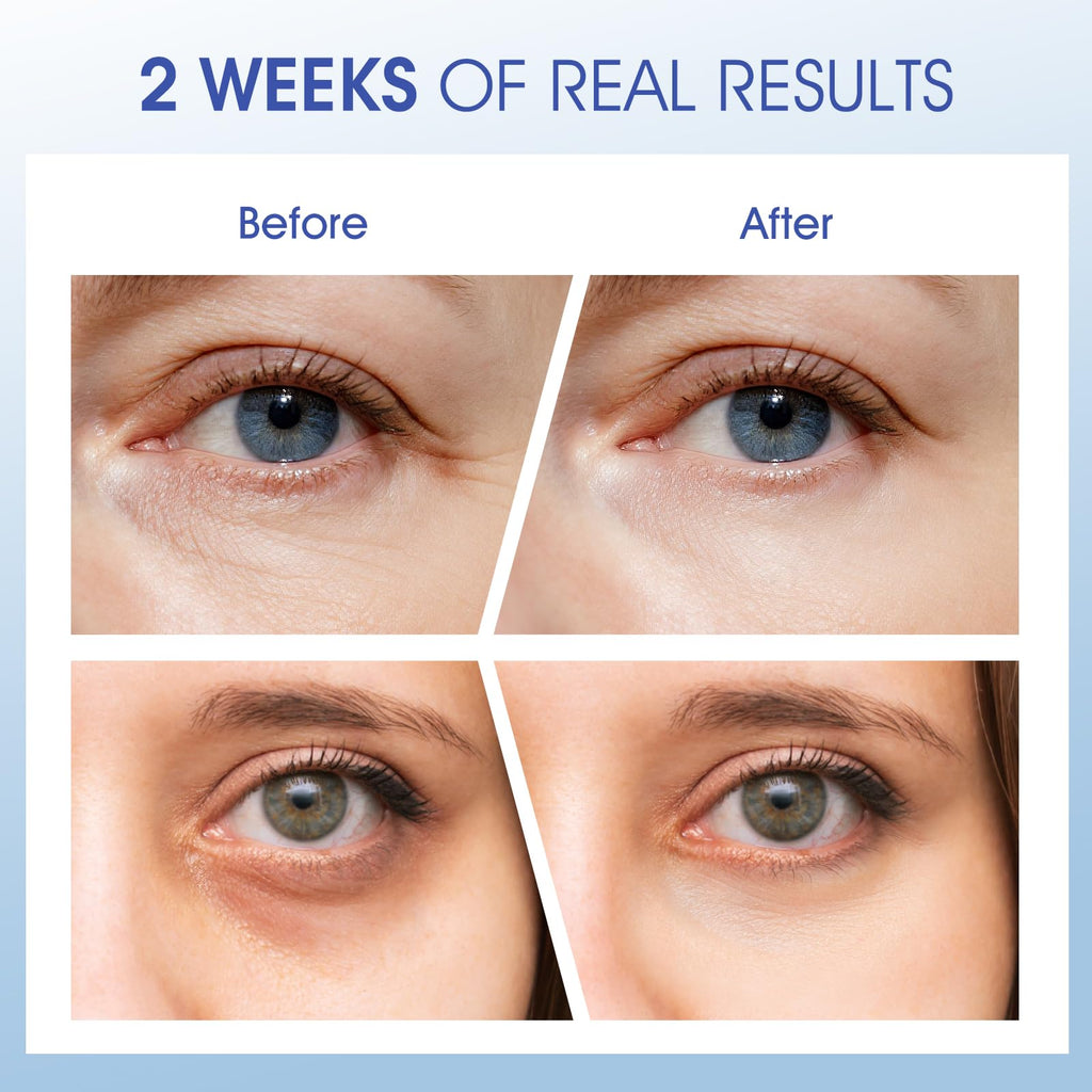 ceedoo Eye Cream for Wrinkles & Fine Lines | Ceramides, Peptides & Caffeine